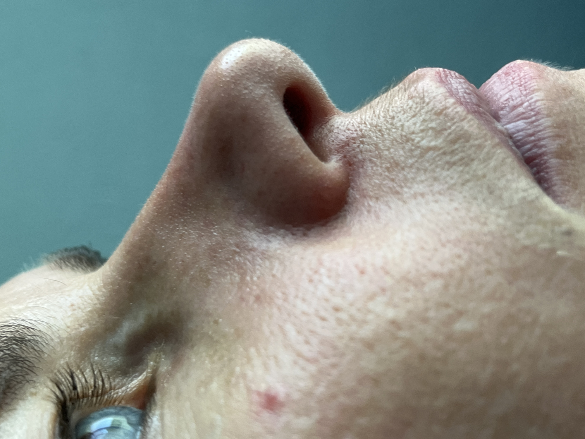 This is a close-up, profile view photograph of a person's face, specifically focusing on the eye, nose, and mouth area. The individual has light skin with visible pores and a few small blemishes. Their eye is blue with long eyelashes. The nose is prominent and appears to have some texture on its surface. The lips are closed and slightly pursed, revealing a natural pinkish hue with subtle lines. The background is a solid, teal-colored wall. The image is taken in a well-lit indoor environment, with no indication of its specific location within ღრმაღელის თემი, Georgia.
