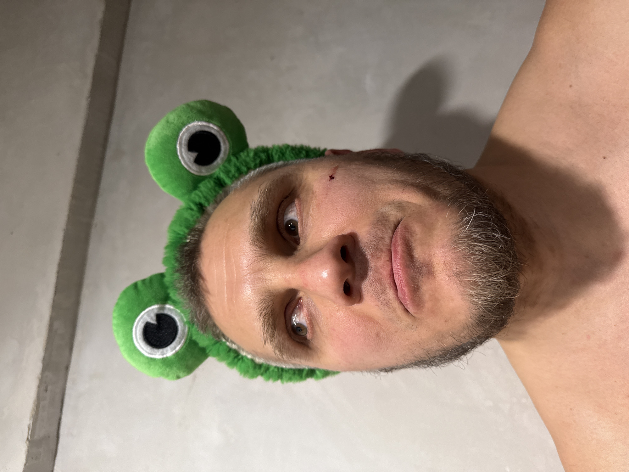 A close-up, portrait-style image depicts a light-skinned, bearded man wearing a green plush headband with large frog eyes attached. A small cut or abrasion is visible on the man's forehead. The background is a plain, light gray wall. The man is facing the camera, with his face taking up the majority of the frame. The setting's location is not discernible from the image.
