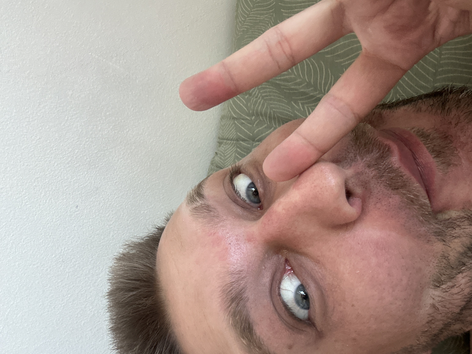 A close-up, low-angle, point-of-view shot shows a man's face, from the forehead down to his mouth, with his right hand held up to his face, fingers extended in a peace sign. The man has short, brown hair and blue eyes that are wide open and looking directly at the camera. His skin is fair with some redness on his forehead and cheeks. He has stubble on his chin and around his mouth. The background is a light-colored wall and a textured green surface, possibly a sofa. The image appears to have been taken indoors. There is no identifiable location in the city of Zvezdara Urban Municipality, Serbia.