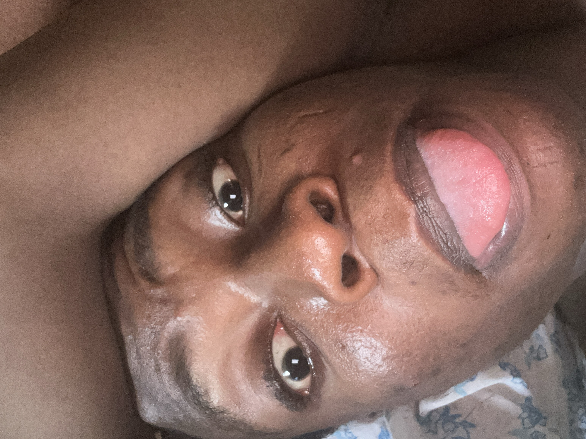 Close-up, tilted view of a person's face with dark skin. The person's head is turned to the side, and their tongue is protruding from their mouth. The eyes are open and appear dark. The skin on the face appears slightly shiny or oily. Part of the person's shoulder or upper arm is visible in the upper left corner. The background appears to be a patterned surface, possibly bedding. No city location can be determined.