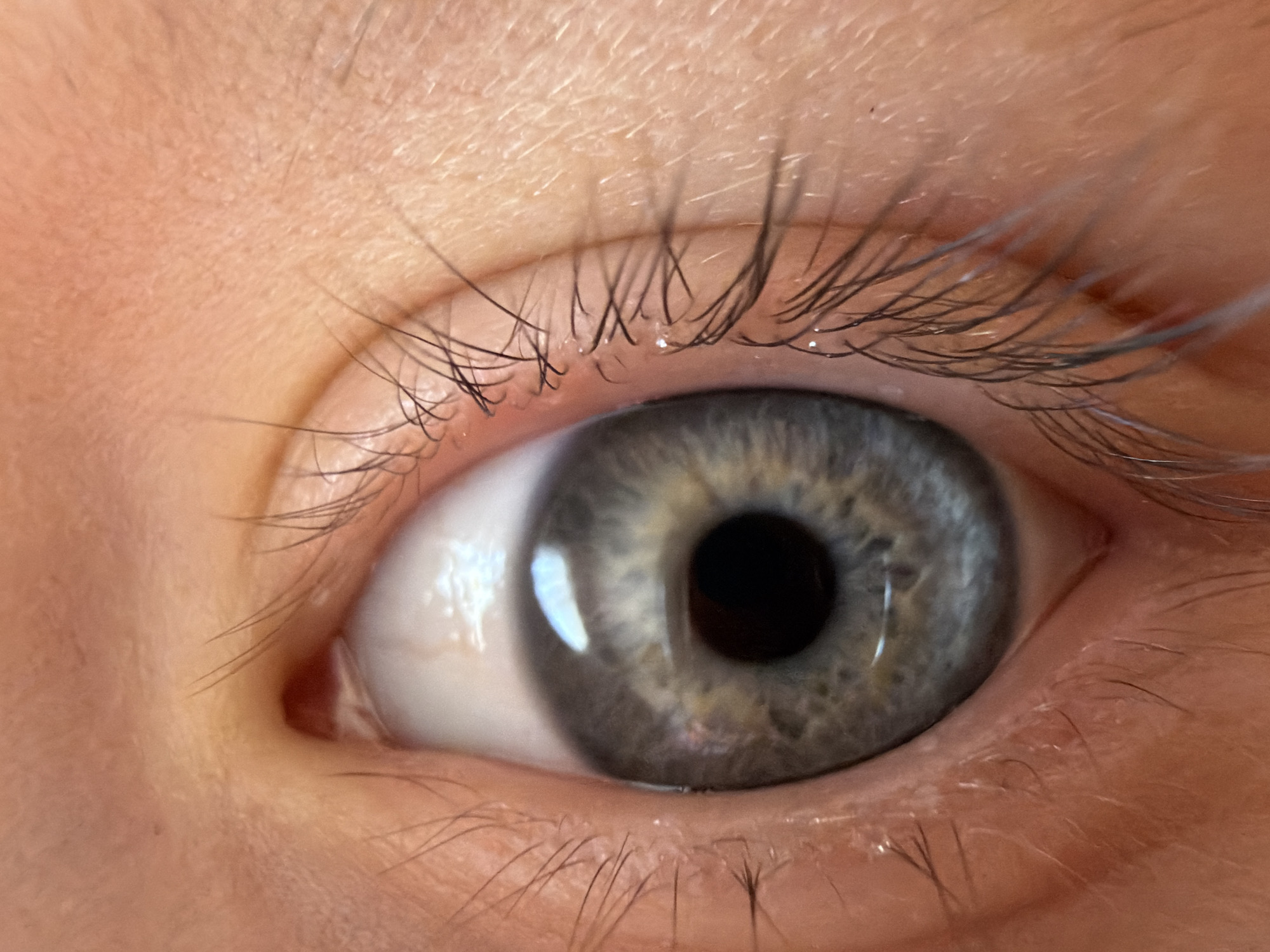 Close-up of a human eye with grey-blue iris and black pupil. The skin surrounding the eye is light pink. There are visible eyelashes both above and below the eye. The image does not provide any information about the location in Chaikovsky, Russia.