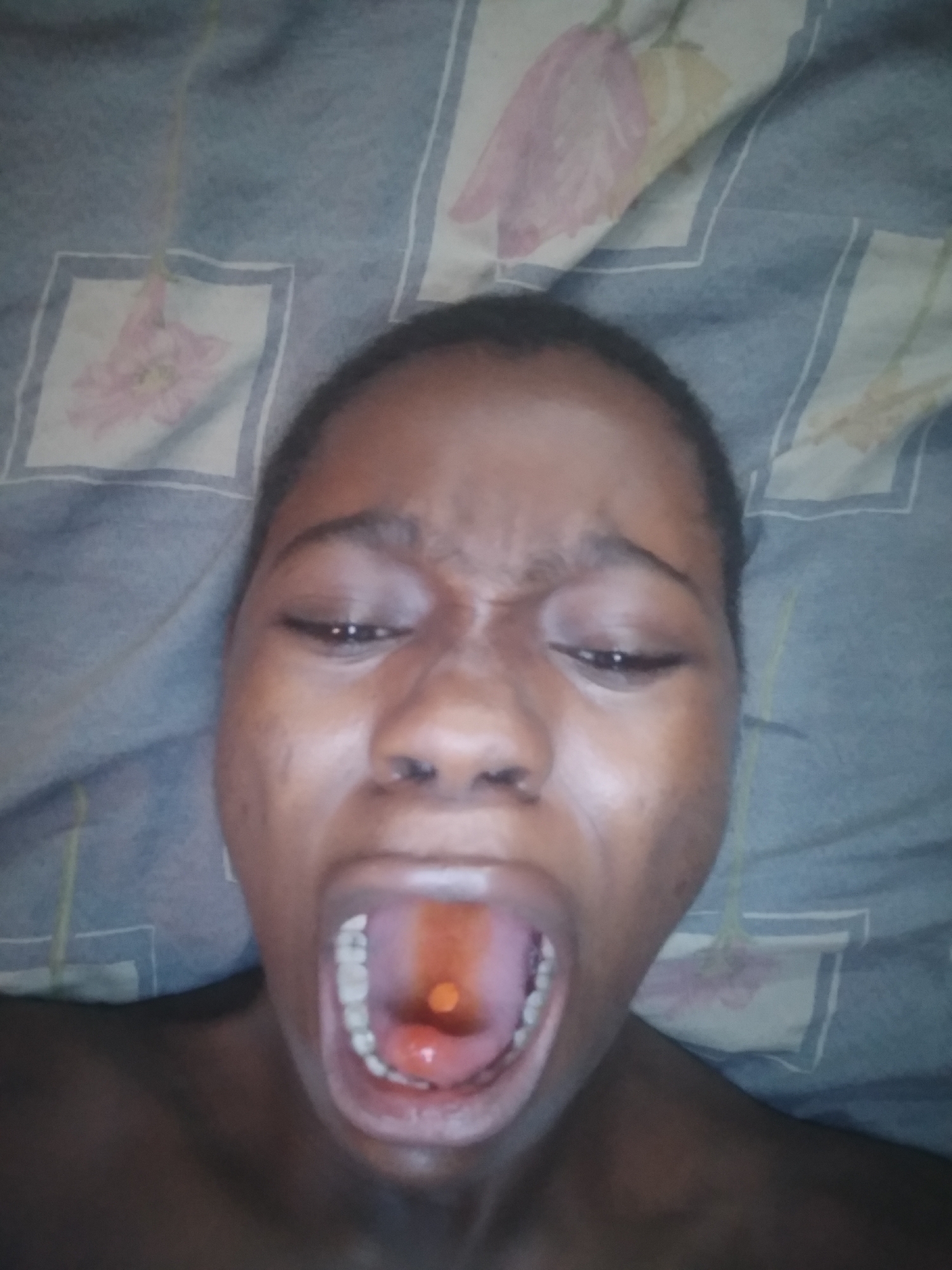 A person is lying down, looking upwards, with their mouth open and a small orange object on their tongue. The person has dark skin and short hair. The background is a patterned sheet. The location is unknown.