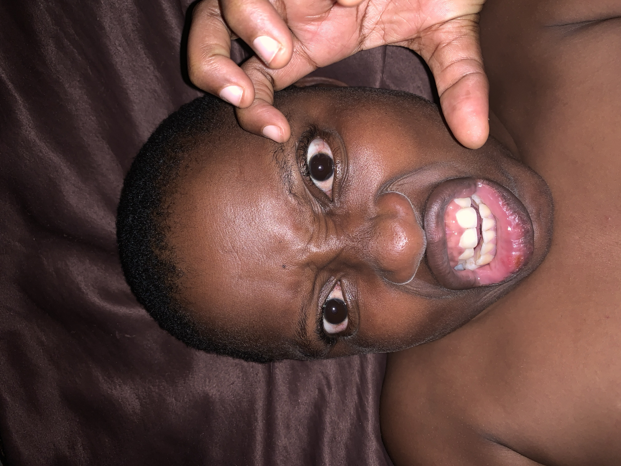 A close-up shot from above depicts a dark-skinned child lying on brown fabric. An adult hand holds the child's left eyelid partially open. The child's mouth is open, revealing teeth. The environment is not clearly defined, and the location in Ikorodu, Nigeria, is not discernible from the image.