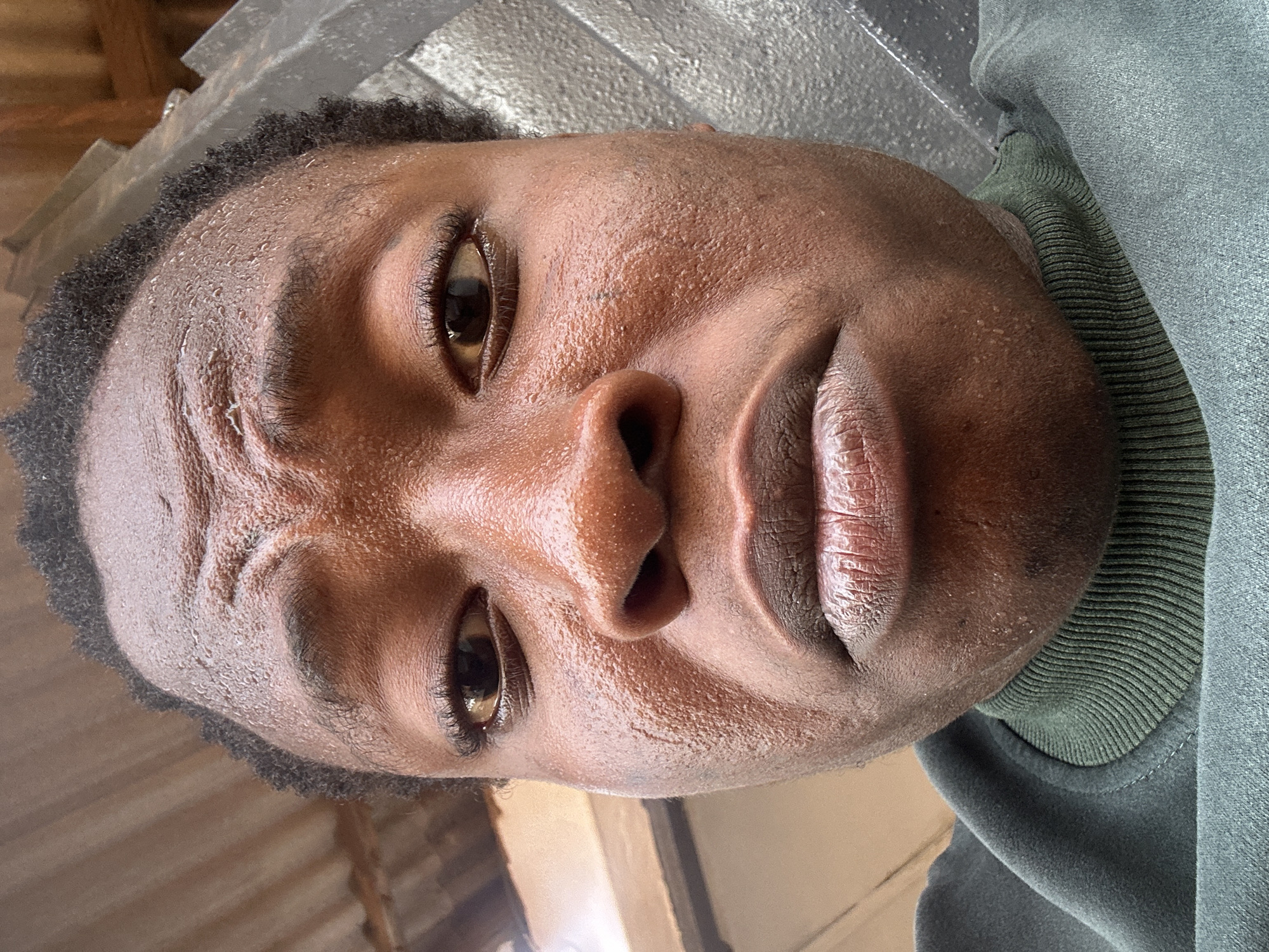 A close-up, vertically oriented portrait shows a young Black man with dark, short hair and brown eyes. The man's skin appears moist, possibly sweaty, and slightly ashy. He has a neutral expression with his lips slightly parted. A green sweatshirt collar is visible on the right side of the frame. The background is blurred, showing what appears to be a corrugated metal roof and possibly a wall, giving a sense of an outdoor or semi-outdoor environment. The location in the city is Unknown, Unknown.
