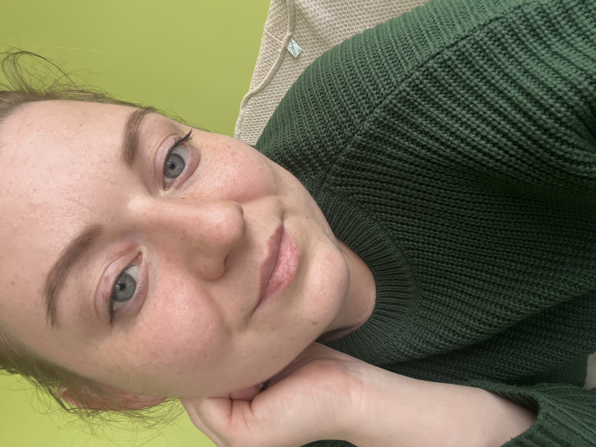 A close-up, slightly angled view of a fair-skinned woman with light-colored eyes and freckles. She's wearing a dark green knit sweater. Her head is resting on her hand. The background consists of a lime green wall and a beige object (likely a pillow or cushion). The location of Klin, Russia, is not discernible from this image.