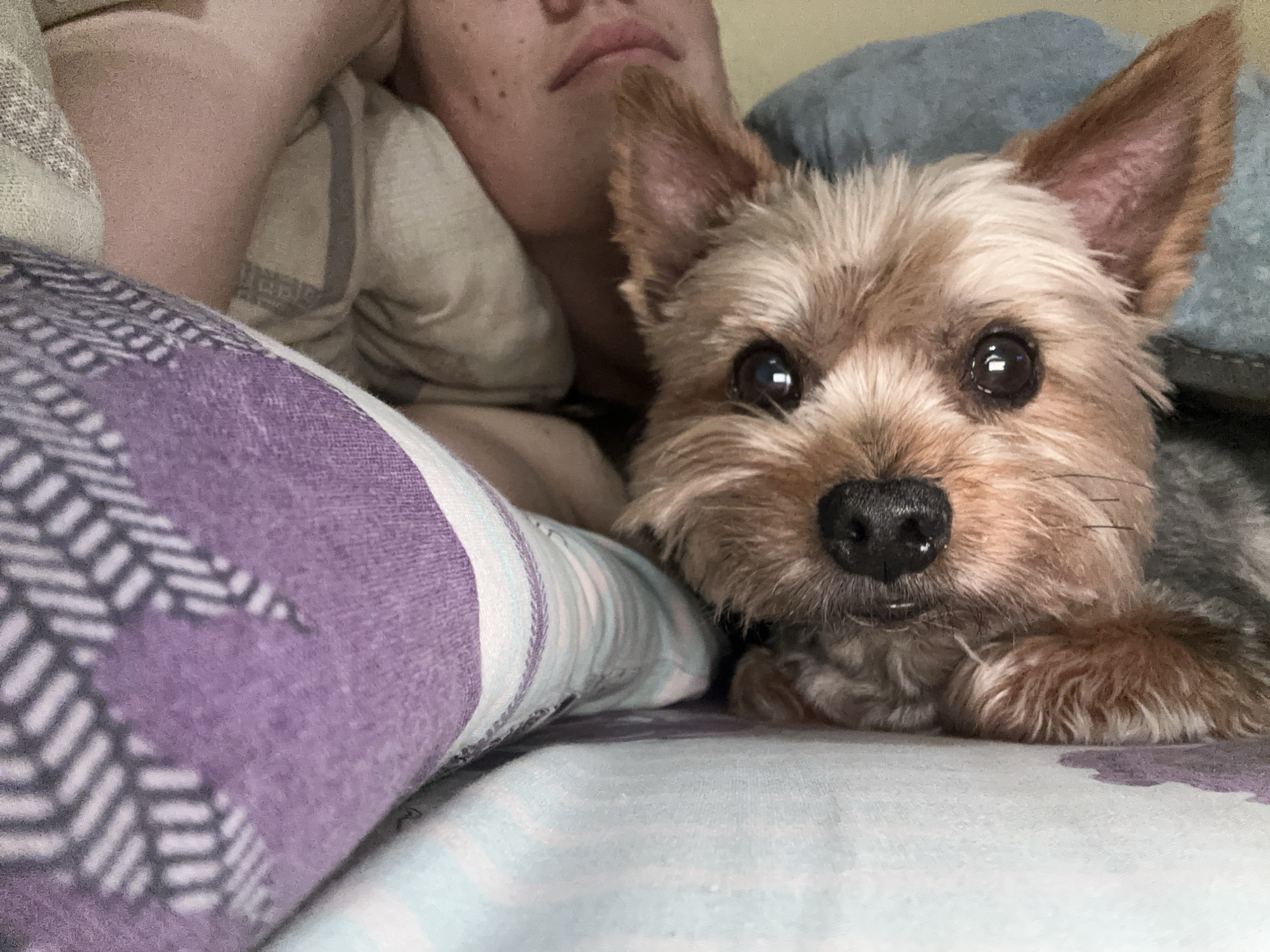 A person and a small dog lie on a bed. The person's face and upper torso are visible, with the dog positioned in the foreground, facing the camera. The bedding consists of a patterned purple pillow and a light-colored sheet. The location is not discernible from the image.