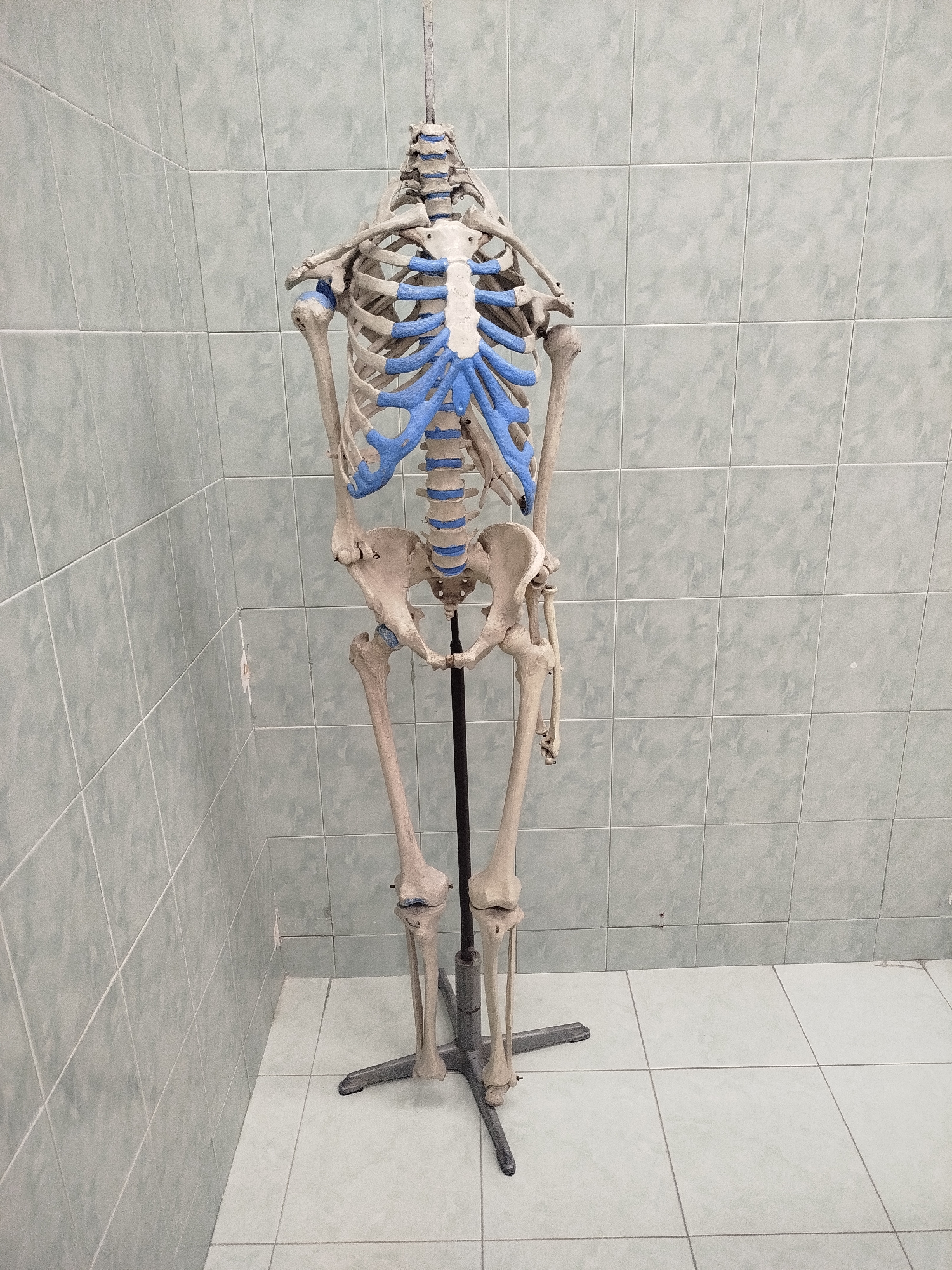 A full skeleton, likely a medical model, stands on a metal stand in the corner of a room with light green tiled walls and floor. The ribs and spine are highlighted in blue. The location is presumed to be in Plovdiv, Bulgaria.