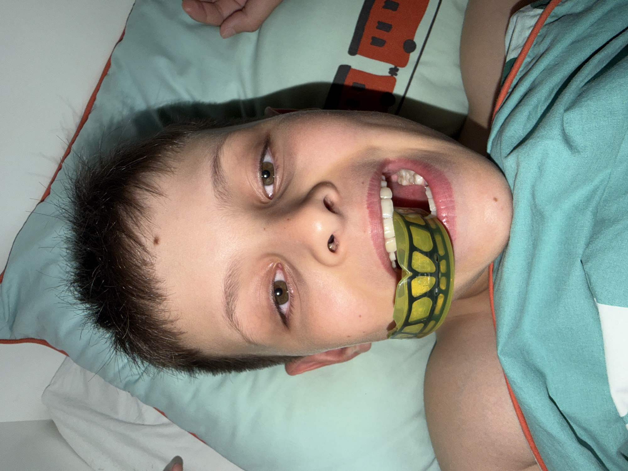 A close-up, overhead shot shows a young Caucasian boy lying in bed, looking directly at the camera. He is wearing a yellow and green mouthguard. The boy has short, dark brown hair and brown eyes. He is wearing a teal colored shirt with a train print. The background consists of a light blue pillow with a red trim and a white pillow. The scene appears to be indoors. There is no information available to determine the location in the city of Votkinsk, Russia.