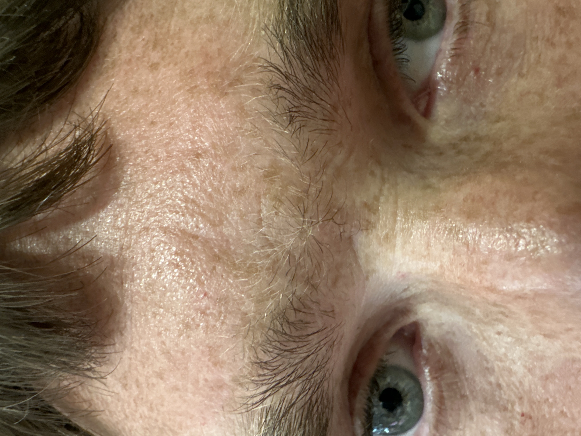 The image is a close-up of a person's eyes and forehead. The person has light-colored skin with freckles and some visible pores. Their eyebrows are dark and bushy. The hair visible at the top of the frame is dark brown. The eyes are light green. The lighting is somewhat harsh, highlighting the texture of the skin. There are no visible elements in the image that would allow for the identification of a specific location within Palma, Spain.
