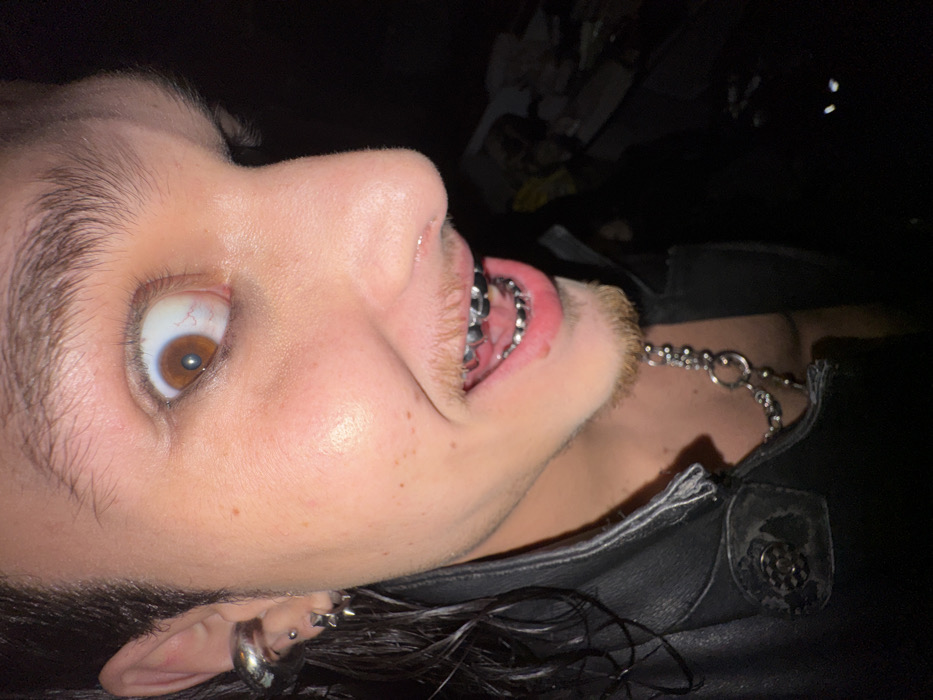The image presents a close-up, high-angle portrait of an individual, likely male, captured from the right side of the face. The subject displays a wide-open right eye with a light brown iris and prominent white sclera, conveying a startled or exaggerated expression. The mouth is open, revealing a full set of silver-colored grillz on both the upper and lower teeth. Dark, possibly wet, hair is visible on the left side of the head, accessorized with a large silver-toned ear cuff on the upper ear and multiple small, star-shaped stud piercings on the lower earlobe. A thin mustache and goatee are present on the face. The individual wears a black leather jacket, featuring a distressed circular button-like detail on the lapel, and a silver-colored chain necklace with various links and rings. The background is predominantly dark and out of focus, indicating night or low-light conditions with the subject illuminated by a camera flash. Minimal indistinct shapes and two small white reflections are discernible in the lower right background. No identifiable landmarks or features are present within the image to determine a specific location within Sofia, Bulgaria, or any other city.