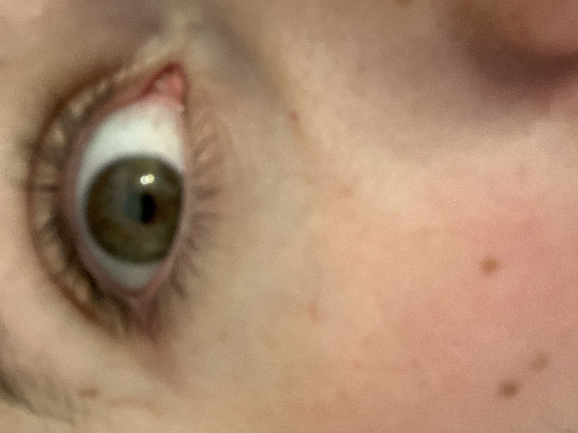 The image is a close-up, somewhat blurry, photograph of a human eye. The iris appears to be hazel or green, and the pupil is dark. The surrounding skin is light-toned with several small moles or freckles visible. A red, slightly raised area can be seen in the corner of the eye, possibly inflammation or irritation. The eyelashes are visible but out of focus. No specific context or location details related to Varna, Bulgaria, are discernible from the image.