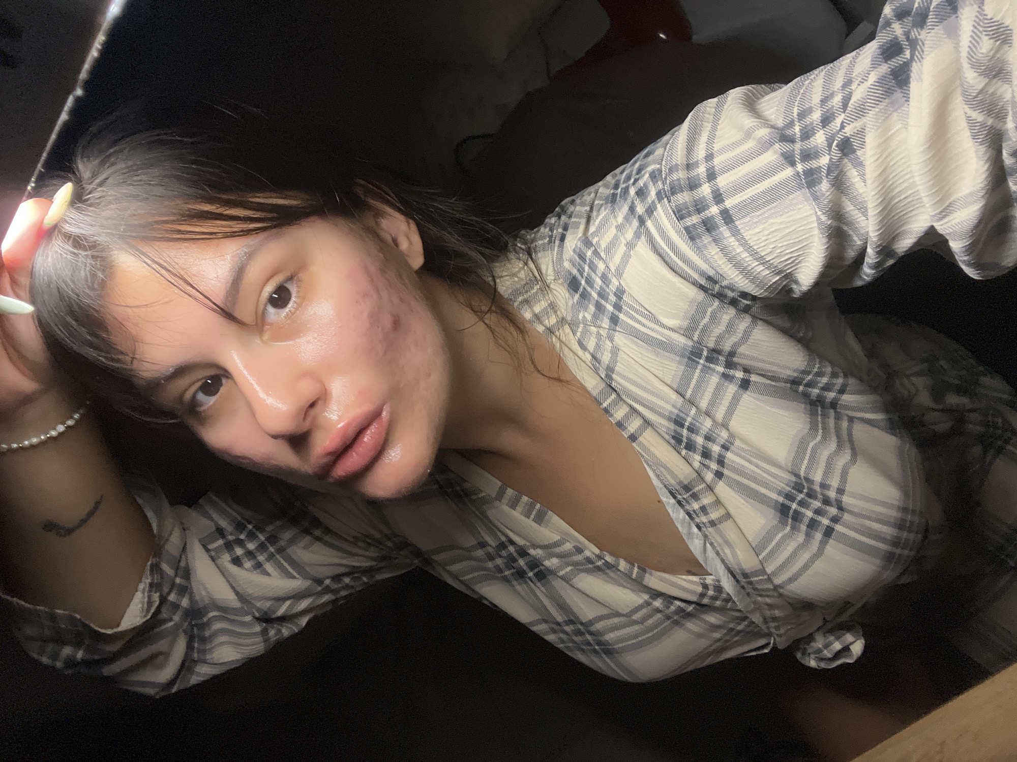 The image is a close-up, high-angle selfie of a young woman with acne on her face. She is wearing a plaid robe and has her hair pulled back. Her left arm is raised, and she is touching her hair with her right hand, which has light green nail polish. The background is dark and out of focus. There is no indication of the location in Kiryat Bialik, Israel.
