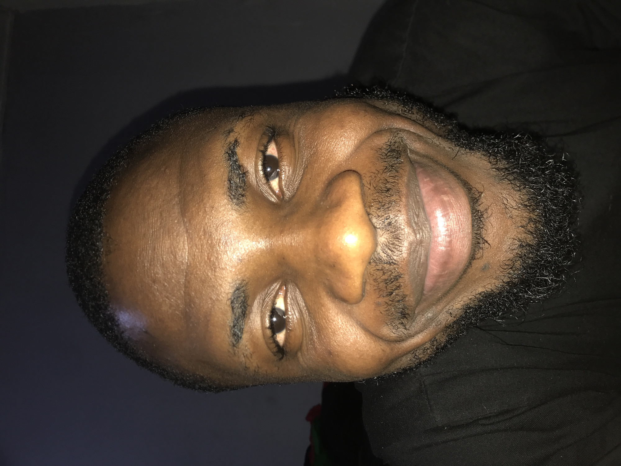 A close-up, head-and-shoulders portrait depicts an adult male indoors in the city of Rafin Par, Nigeria. The subject has a dark brown complexion with visible skin texture and reflective highlights on the forehead, nose, and cheeks, suggesting an oily or moist surface. His short, dark, curly hair is visible around the top and sides of his head. He possesses dark, thick eyebrows, and his dark brown eyes are open, with a noticeable reddish tint in the conjunctiva, particularly in the viewer's right eye. The nose is broad. A full, dark, short beard and mustache frame a wide smile, which reveals slightly parted, pinkish-brown lips without teeth. The subject is wearing a dark-colored, likely black, collared shirt or t-shirt with a visible ribbed texture on the fabric. The background is uniformly dark and indistinct, suggesting a plain wall or interior space under low illumination, with no discernible objects or features. The subject is smiling broadly, directly facing the camera.