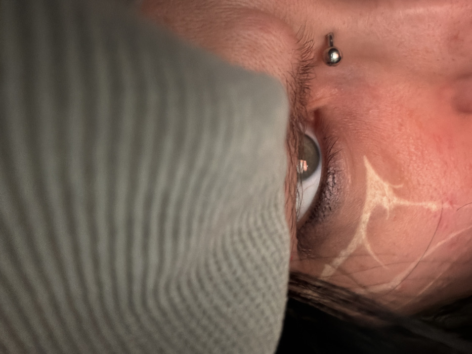 The image presents a tightly cropped, vertical close-up of the upper right portion of a human face. A light grey, horizontally ribbed fabric, likely a knitted garment, partially obscures the forehead and upper head. The subject's right eye is centrally focused, displaying a light brown to hazel iris with a distinct, small, bright rectangular reflection, indicating a direct light source such as an electronic screen. Dark eye makeup is applied around the eye. A silver-colored horizontal barbell piercing is visible on the upper right cheekbone, situated beneath the outer canthus of the eye. On the subject's right cheek, a series of prominent, light-colored, raised linear and abstract scarifications are present, surrounded by areas of localized erythema. Dark hair is visible along the left periphery of the frame. The subject's gaze is directed forward. The overall lighting is low-key, with direct illumination accentuating the facial features. This scene is located in the city of Sofia, Bulgaria.