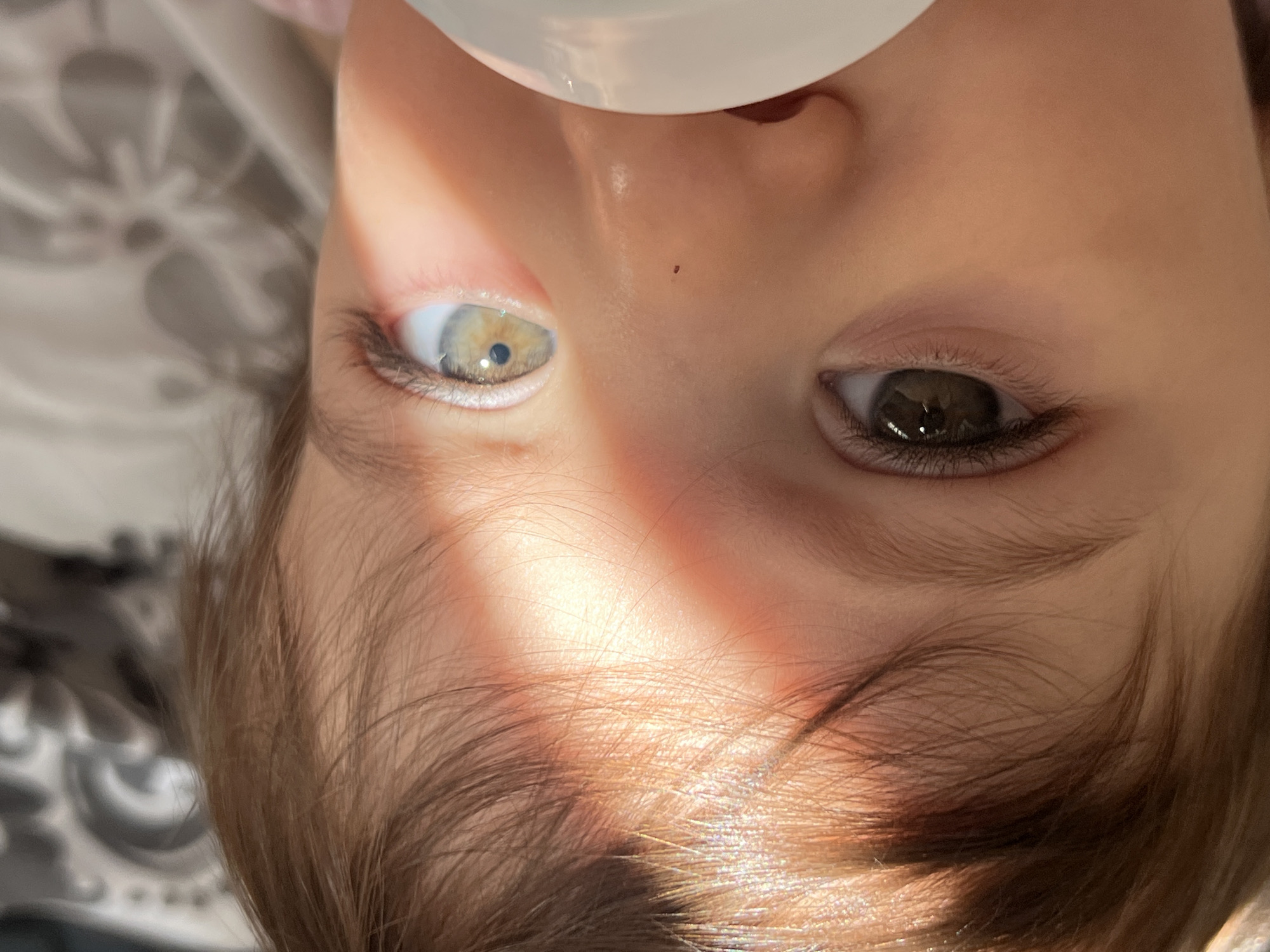 The image shows a close-up of a baby's face, focusing on their eyes and nose. The baby has heterochromia, with one eye appearing dark brown and the other a lighter hazel or green color. A ray of sunlight crosses the baby's face from left to right, illuminating their forehead and the lighter colored eye. The baby's skin is fair and smooth. A small brown mole is visible on the bridge of the baby's nose. The lower part of the image is obscured by a white, opaque object, possibly a bottle nipple or pacifier. The background is out of focus and appears to be a patterned fabric, possibly bedding. The image is a portrait and does not depict any urban or specific geographical location.
