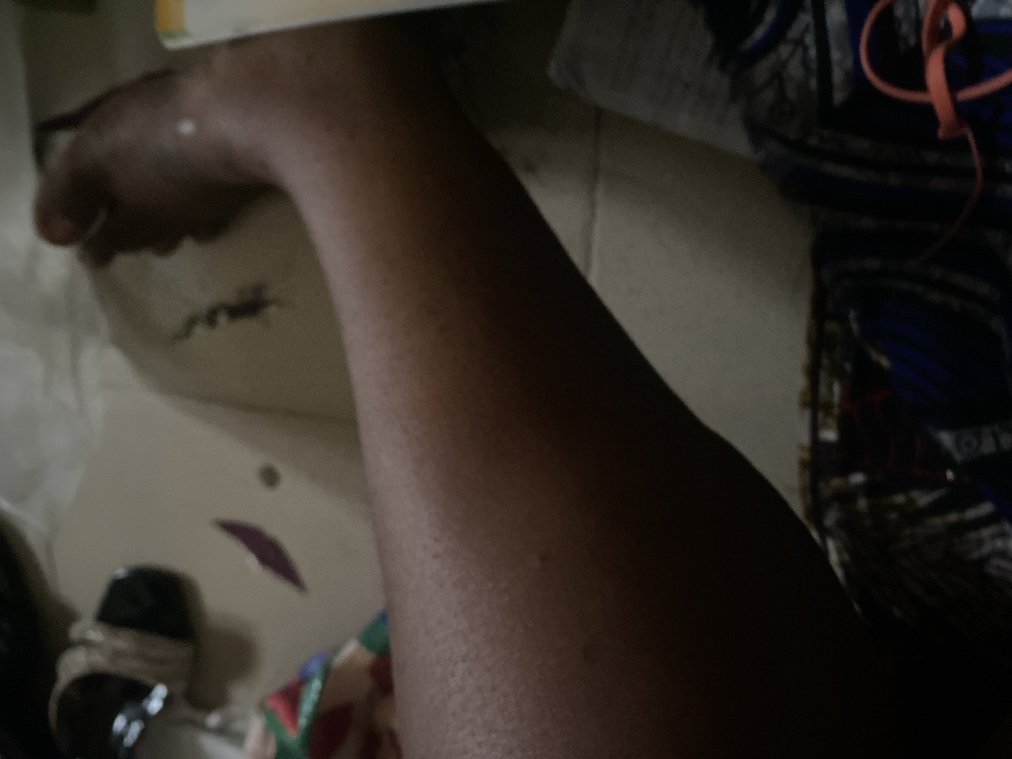 The image shows a person's lower leg and foot. The skin tone is dark brown. There are some small bumps or pores visible on the skin. The foot appears to be resting on a patterned fabric. In the background, there are some blurry objects which are difficult to identify. There is no clear indication of the location being the city of Jauro Yinu, Nigeria.