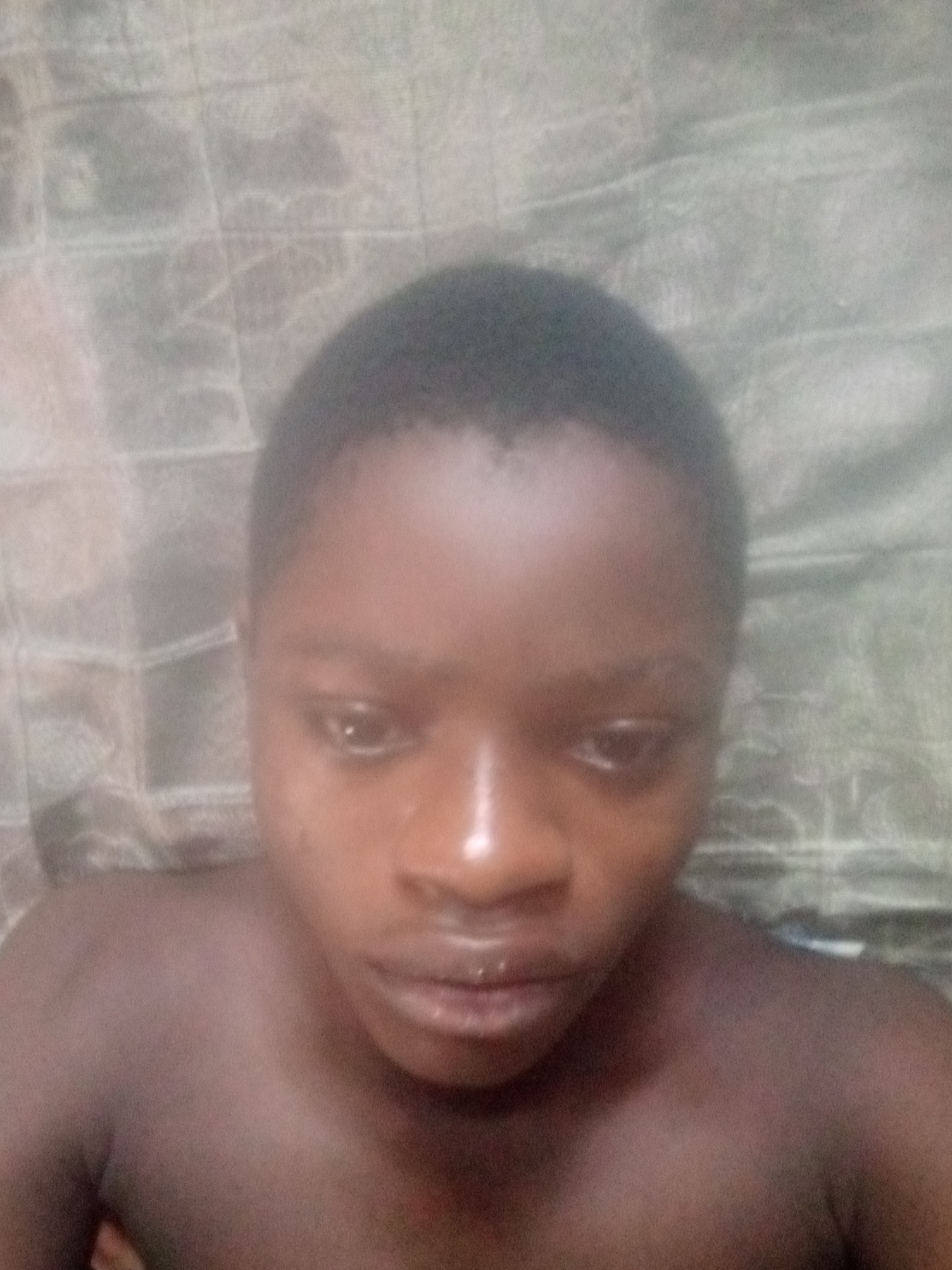 A close-up, unflattering shot of a dark-skinned person with a shaved head. The person appears to be lying down on a patterned cloth, possibly a bedsheet. The subject's shoulders are visible. The location is unknown, including the city of Shangisha, Nigeria. No specific actions or interactions are discernible.