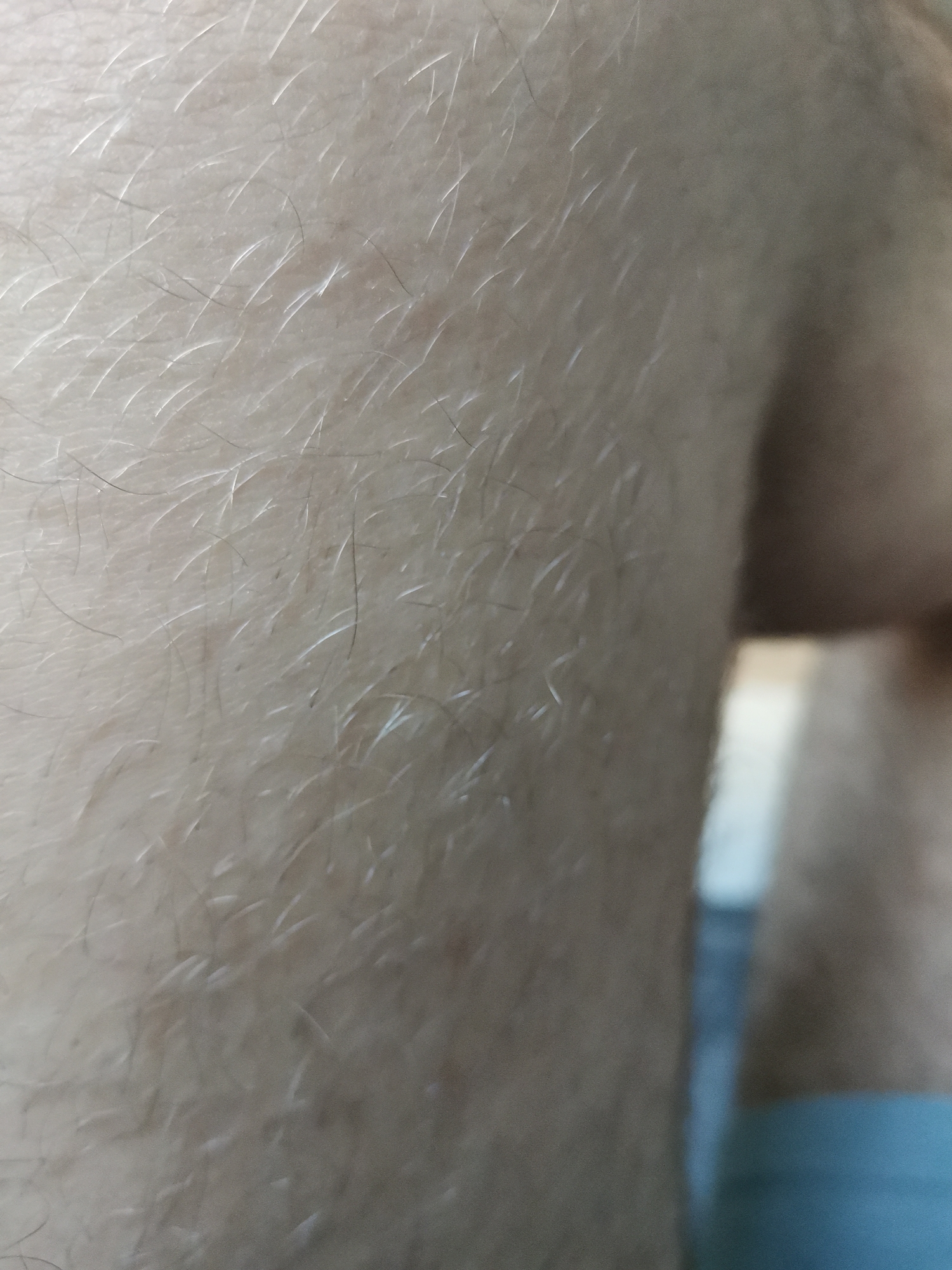 The image displays a close-up, detailed view of human integument, specifically light-toned skin and hair, observed in the city of Pokrovnik, Bulgaria. The central focus is on a section of skin covered with a dense distribution of fine, predominantly light-colored (vellus) hairs. Several darker, thicker terminal hairs are also interspersed among the lighter growth. The hairs exhibit varied orientations and lengths, with many reflecting incident light, creating distinct highlights. The texture of the skin appears uniform with subtle dermatoglyphic patterns. The background, particularly towards the right and bottom right, is out of focus. A segment of light blue fabric, consistent with an article of clothing or underwear, is visible in the lower right portion of the frame. The lighting suggests an indoor setting with a diffused light source from the upper left. No discernible actions or interactions are depicted.