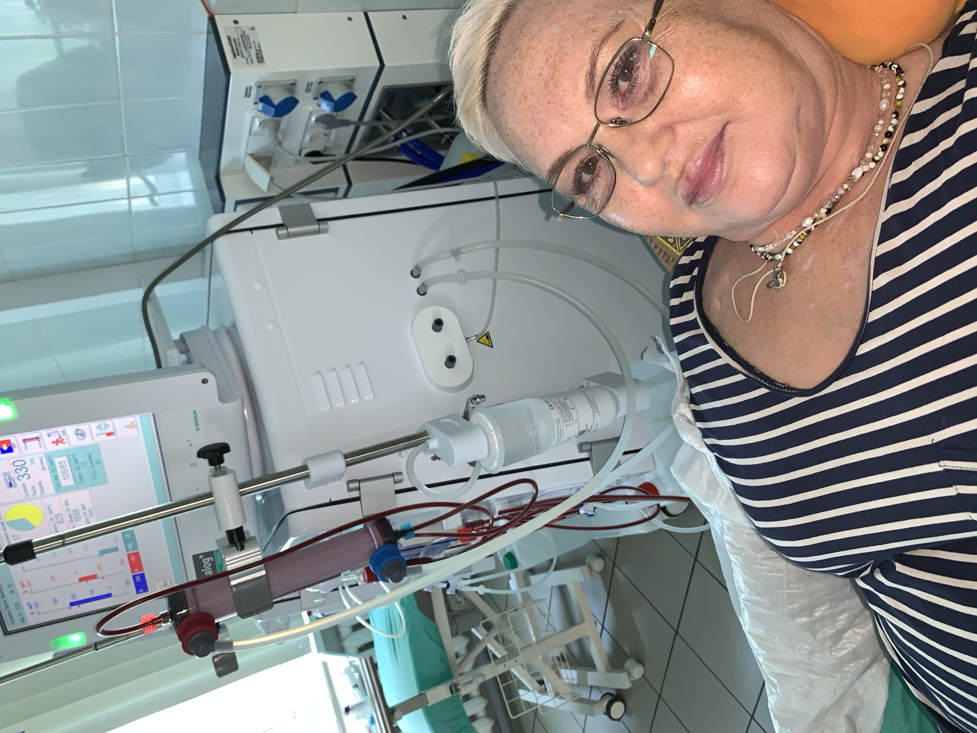 Here's a detailed description of the image:
**Scene:** The image shows an individual, likely a patient, in what appears to be a medical setting, possibly a dialysis unit.
**People:**
* A middle-aged woman with fair skin, freckles, and short blonde hair is prominently featured. She is wearing glasses and a navy blue and white striped top. She is also wearing multiple necklaces.
**Subjects/Objects:**
* A dialysis machine is in the background. It has various tubes, pumps, and a screen displaying medical data. Specific brandings or logos on the machine may provide further detail.
* Medical equipment, including tubing and a fluid container, are visible.
* The individual is lying on what seems to be a medical examination table covered with a white protective sheet.
* The presence of floor tiles suggests an institutional environment.
**Actions/Interactions:**
* The woman is looking directly at the camera, perhaps taking a selfie.
* The individual is likely undergoing a medical procedure based on the equipment surrounding them.
**Environment:**
* The setting is clean and sterile, typical of a medical environment.
**Location:**
Given the provided information, the location is specified as the city of Chaikovsky, Russia. However, there is no information to confirm this location from the image itself.