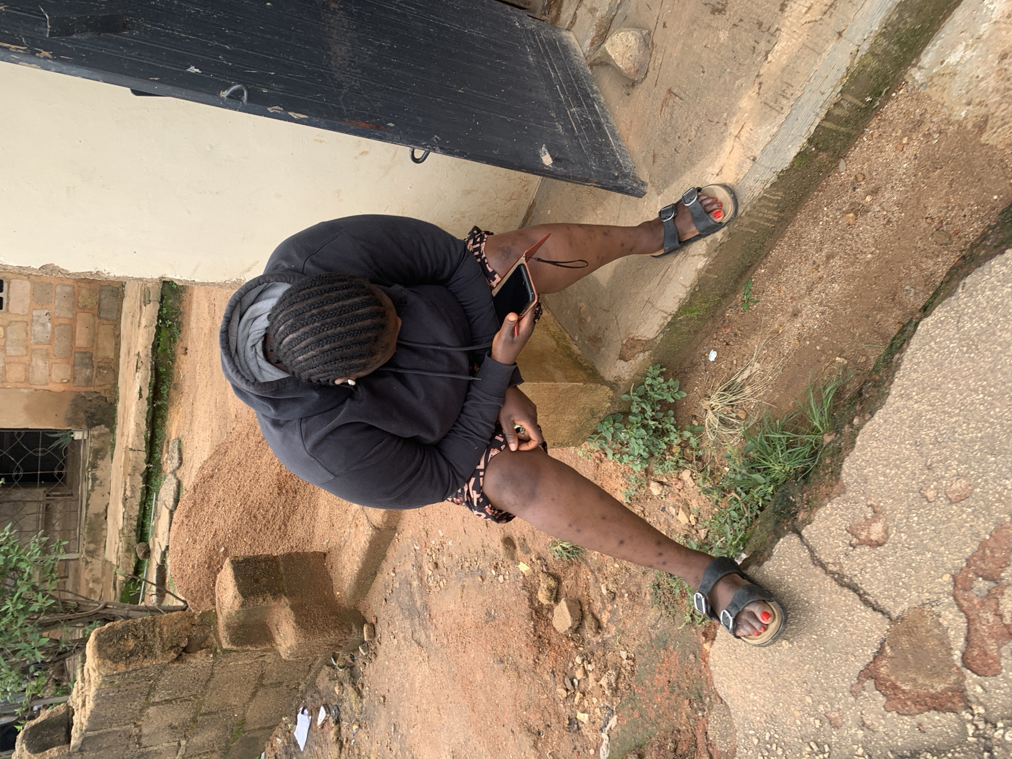 A person is sitting on a concrete ledge in Jos, Nigeria, with their head bowed and looking at a smartphone. The person is wearing a dark hoodie and patterned shorts, with dark sandals on their feet. Their legs appear to have a rash or insect bites. The background shows a brick wall, a pile of sawdust, and a doorway. The ground is a mixture of dirt and concrete, with some sparse vegetation.