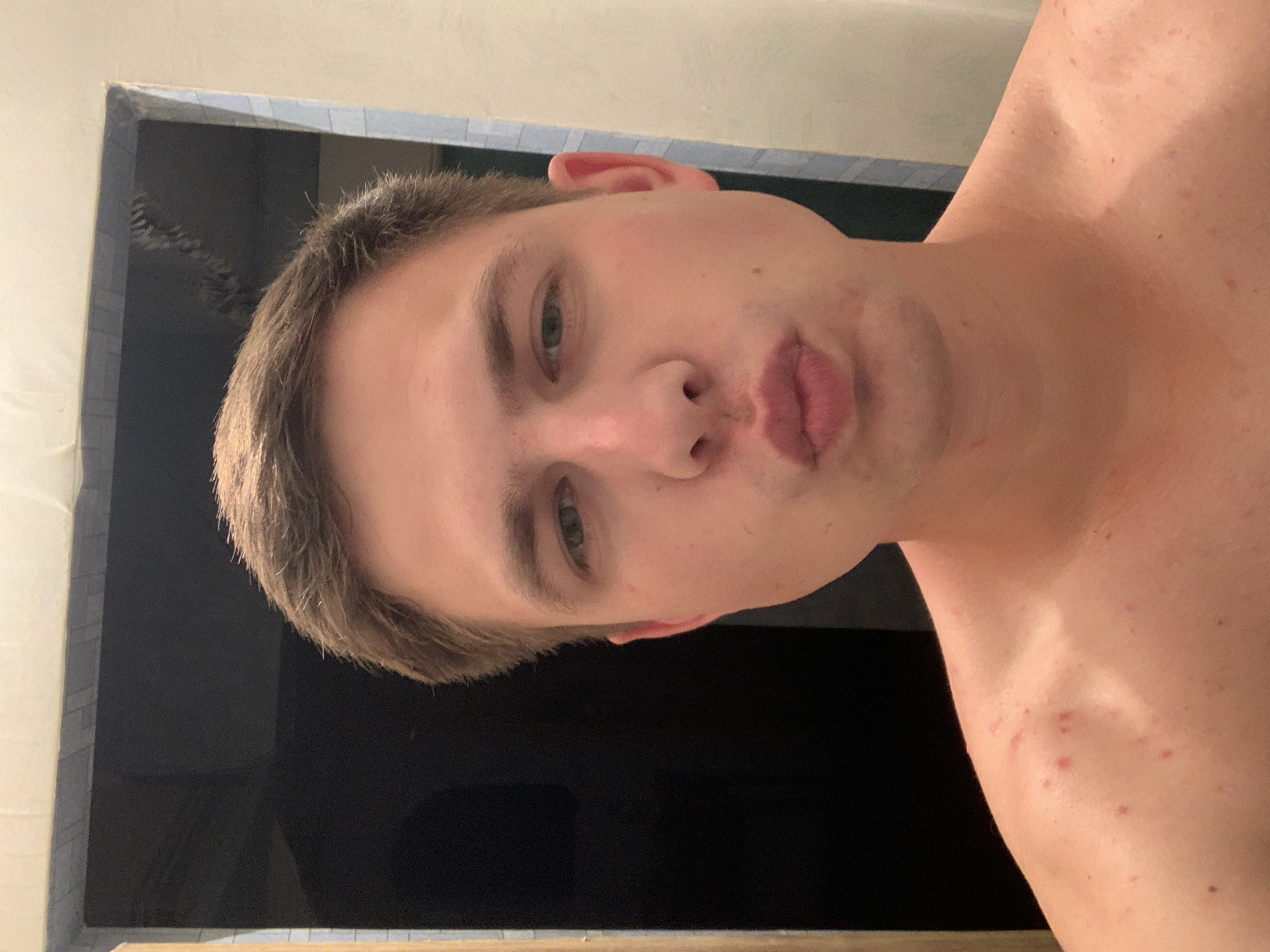 A close-up, chest-up, selfie-style photograph shows a fair-skinned young adult male with short brown hair and blue eyes. He is looking directly at the camera with his lips puckered into a kiss. The subject is shirtless, revealing a light dusting of red blemishes on his left shoulder and upper chest. The background is blurred but appears to be a bathroom with tiled walls and a dark opening, possibly a doorway or shower. The lighting suggests an indoor setting, likely in the evening. The image is sharp and well-lit, capturing the subject's facial features and skin texture.