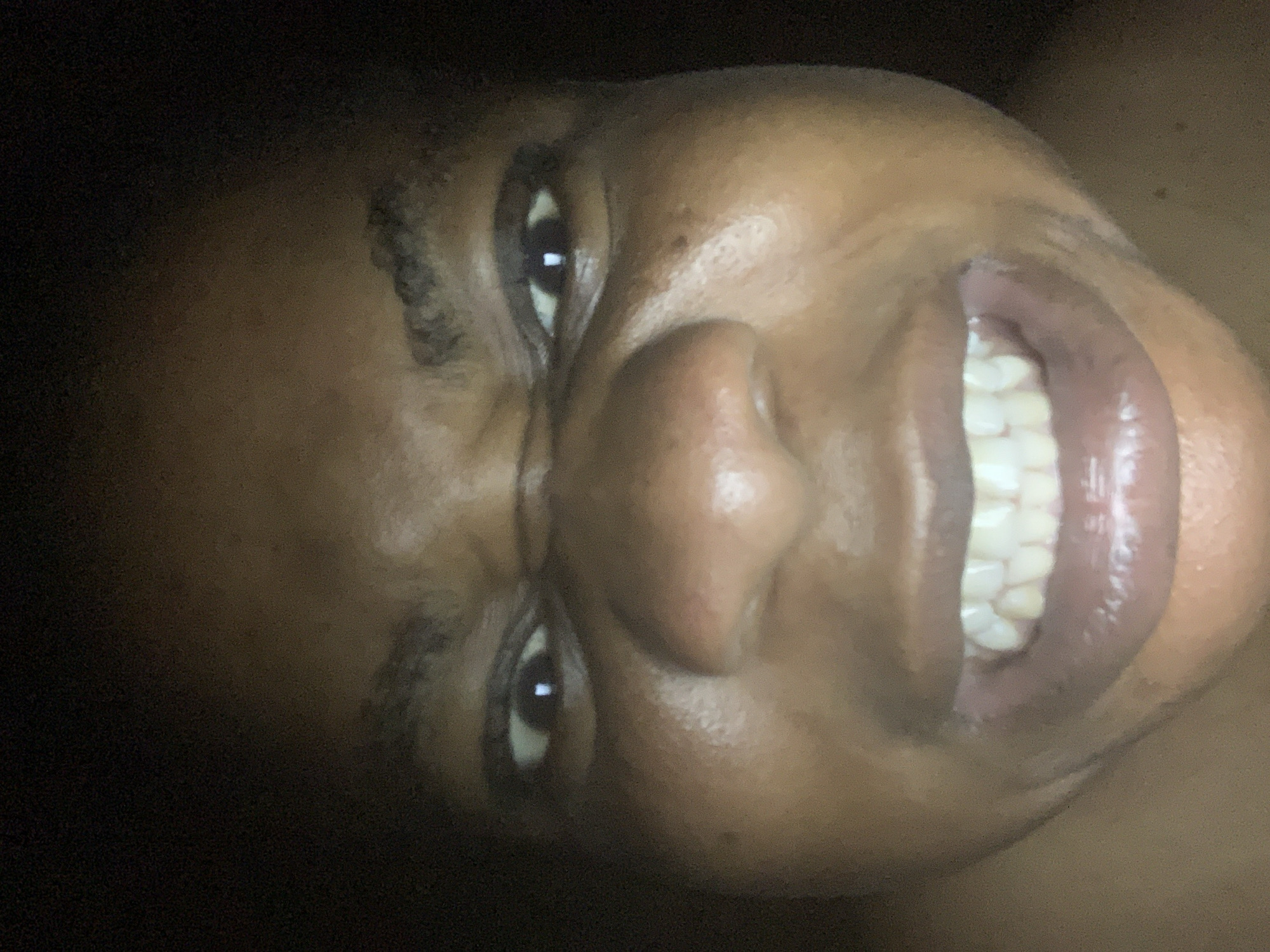 The image depicts a close-up view of a person's face. The person has dark skin, dark eyes, and visible teeth. The environment is dimly lit, with the background appearing dark. The location is Unknown, Unknown.
