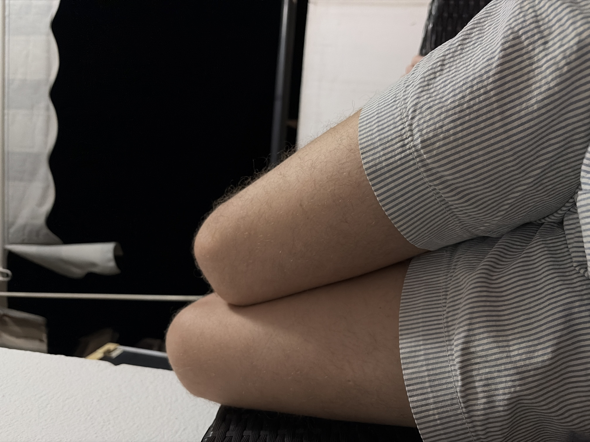 The image presents a close-up view of a person's forearm resting on their legs. The person is wearing a light blue and white striped collared short-sleeved shirt. The foreground shows a close-up of the skin on their crossed forearms and legs, revealing fine hair. The location appears to be indoors, possibly a room or enclosed space, given the presence of a white curtain-like structure and dark background in the top left. There are hints of a black woven chair, upon which the legs and arm likely rest. Given the context of Budva, Montenegro being mentioned, the image may have been taken in an indoor setting there, but without further contextual information, this cannot be definitively confirmed.