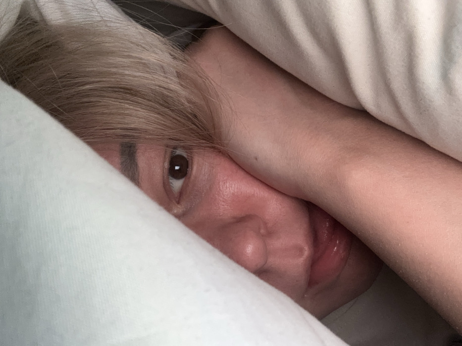 A close-up image taken in Izhevsk, Russia, depicts a person's upper face partially concealed by white or light-colored bedding. One brown eye is visible, looking directly towards the camera. Strands of light blonde hair fall across the forehead, partially obscuring the upper part of the visible face. The nose and lower lip, with the tip of the tongue slightly exposed, are discernible. The skin on the visible cheek and around the nose appears reddish. A forearm, with fair skin and a small mole on the distal aspect, rests against the lower part of the face or a light-colored pillow, which supports the person's head. The scene indicates an indoor environment, likely a bed, with soft, ambient lighting.