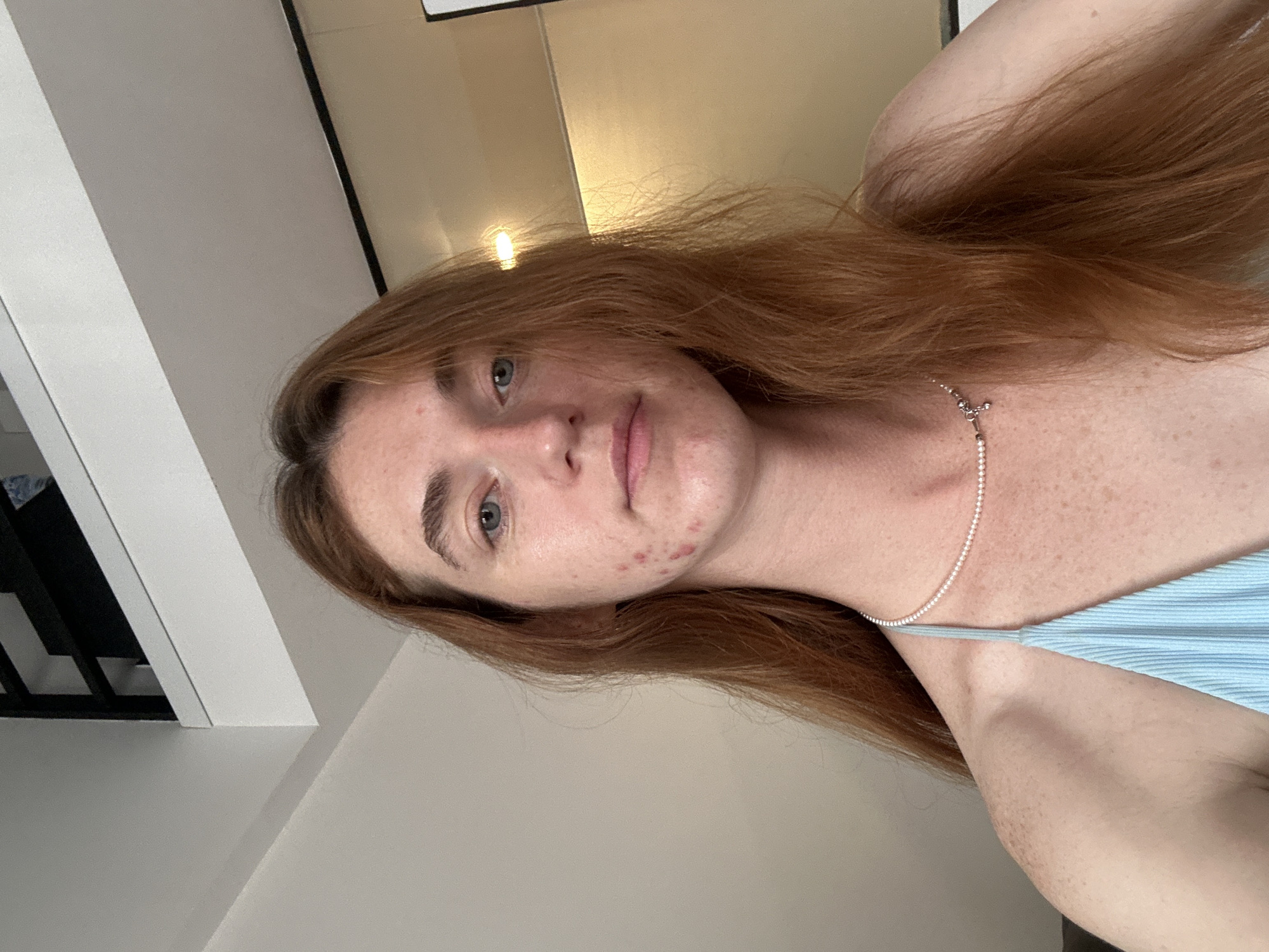 A close-up, portrait-style photograph features a young woman looking directly at the camera with a neutral expression. She has long, wavy reddish-brown hair that cascades over her shoulders and fair skin, noticeably freckled across her chest and neck. Her eyes are a light blue or grey hue, complemented by natural-looking eyebrows. Several red blemishes are visible on her chin and jawline.
She is dressed in a light blue top with a ribbed texture, possibly a tank top or camisole, with a thin strap visible over her shoulder. Around her neck, she wears a delicate silver chain necklace with a small cross pendant.
The background indicates an indoor setting, likely a modern interior. A light grey or off-white wall is visible on one side, while a warmer, light beige wall or ceiling is seen on the other, reflecting a soft, warm light, possibly from an artificial light source. Hints of white and black architectural elements, resembling modern railings or banisters, are discernible in the background, suggesting a space within a building, such as a hotel room or apartment in Baan Chaweng, Thailand. The image appears to be a casual selfie or portrait. No text is visible in the frame.