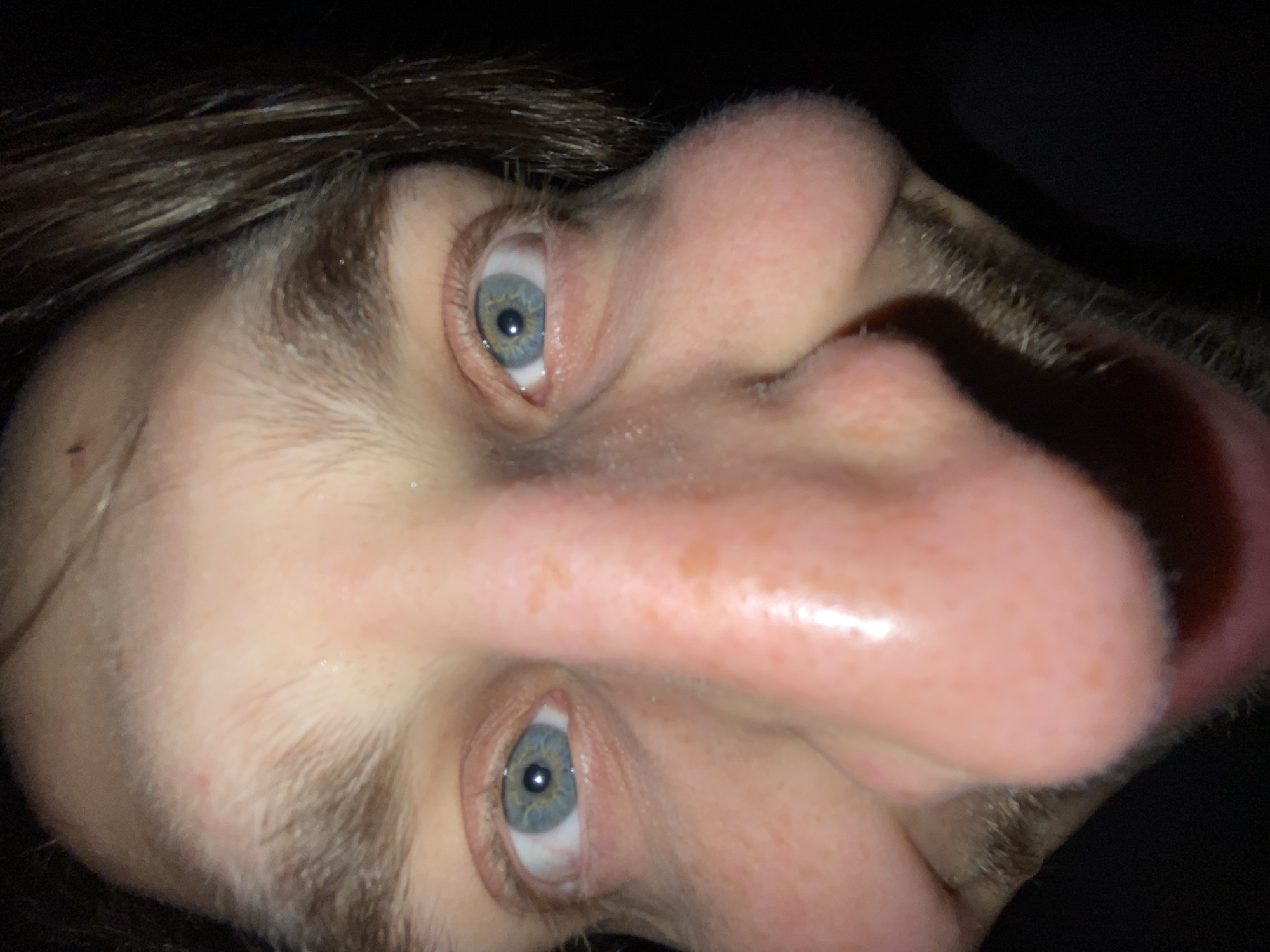 The image presents an extreme close-up portrait of a person's face, likely a selfie, captured from a distorted, wide-angle perspective, with the head oriented vertically. The central and most prominent feature is the greatly exaggerated and bulbous nose, appearing disproportionately large due to the close proximity to the camera lens.
Two striking blue-green eyes with clearly visible pupils and some red veins in the sclera (whites of the eyes) stare directly forward. Dark brown hair is visible on the head and as eyebrows and stubble around the face. The skin has a fair complexion, showing visible pores, fine facial hair, and a few small freckles or blemishes, including a small red mark on the cheek/temple area. The tip of a pink tongue is slightly visible on the far right side of the main image.
The background is predominantly dark or black, suggesting an indoor setting or low-light conditions. Reflections in the eyes indicate a direct light source, possibly a camera flash or a screen. The overall impression conveyed is that of a playful or experimental close-up shot, emphasizing facial features through distortion. There is no visible text in the image. The provided context for the location is Šušanj, Montenegro.