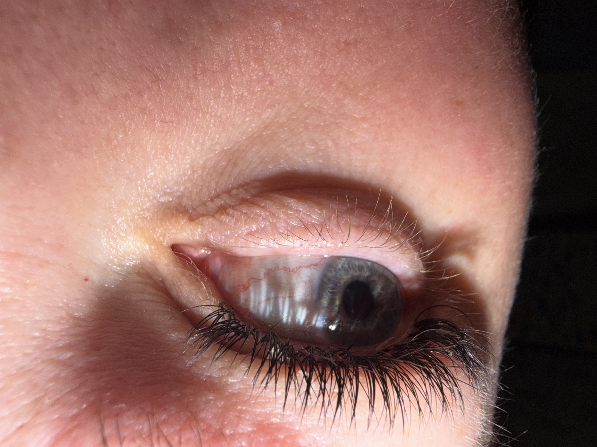 A close-up photograph depicts a human eye with light skin surrounding it. The eye features gray-blue iris. The eye has both upper and lower eyelashes, with skin pores clearly visible around the eye area. The presence of shadows suggests a nearby light source. The setting or exact location within Chaikovsky, Russia, cannot be determined from the given image.