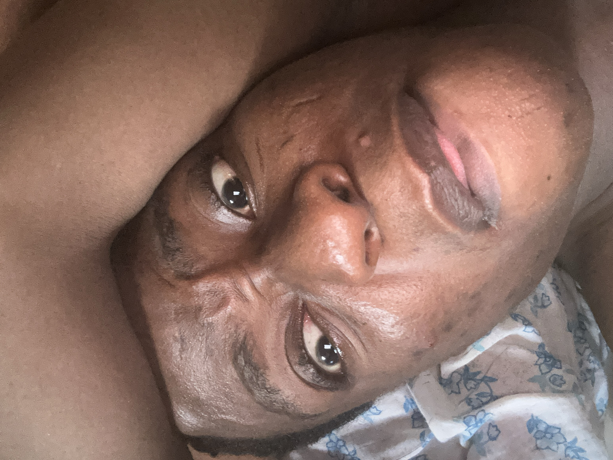 The image is a close-up of a Black person's face. The person is lying down on a bed with a patterned white and blue floral sheet or pillow. The person's head is tilted to the side. Their eyes are open and looking at the camera. The lips are slightly parted. The image does not include any information about the city or any specific subjects, objects, or interactions. The environment is limited to the bed surface.
