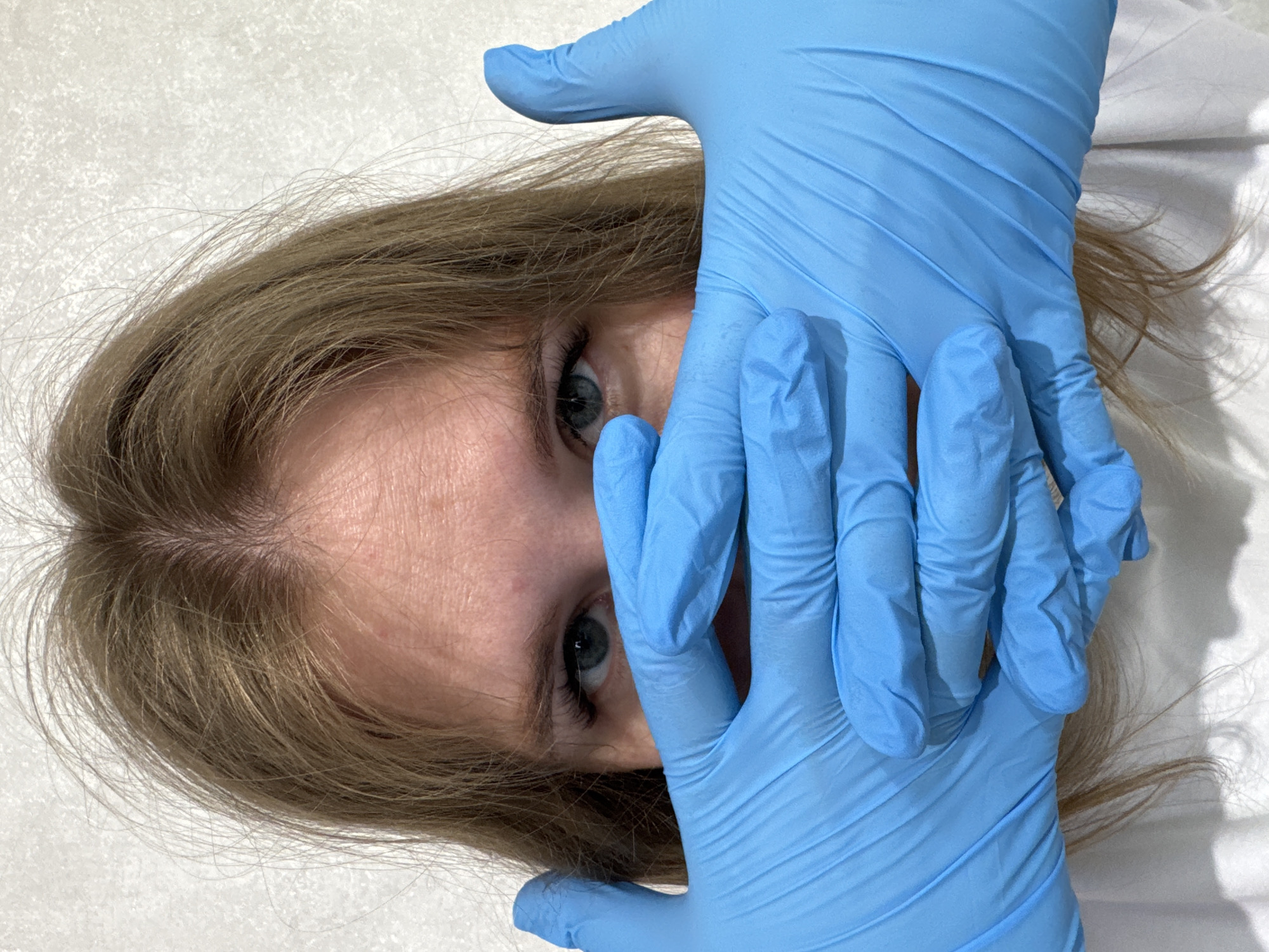 The image shows a fair-skinned individual with blonde hair, their face partially obscured by two hands covered in light blue surgical gloves. Only their eyes and a portion of their forehead are visible. The background is a light, possibly white, surface. The image gives no indication of the location or specific actions taking place.
