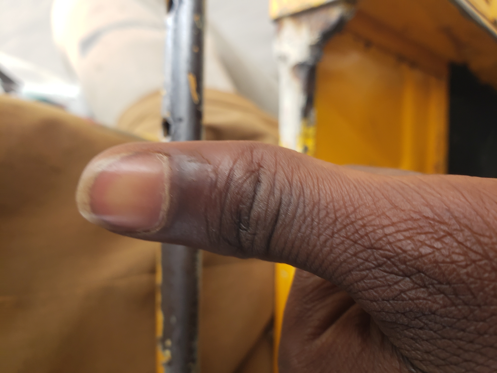 The image is a close-up, upward-angled shot of a person's thumb giving a thumbs-up gesture. The thumb is dark-skinned and shows prominent skin texture and lines. The fingernail appears somewhat discolored or bruised, with a purplish hue at the base and a lighter, translucent tip. The thumb is positioned in front of a blurred background consisting of yellow and brown elements, suggestive of a vehicle or structure, possibly a rickshaw or cart, common in the city of Jos, Nigeria. The lighting suggests an outdoor environment.