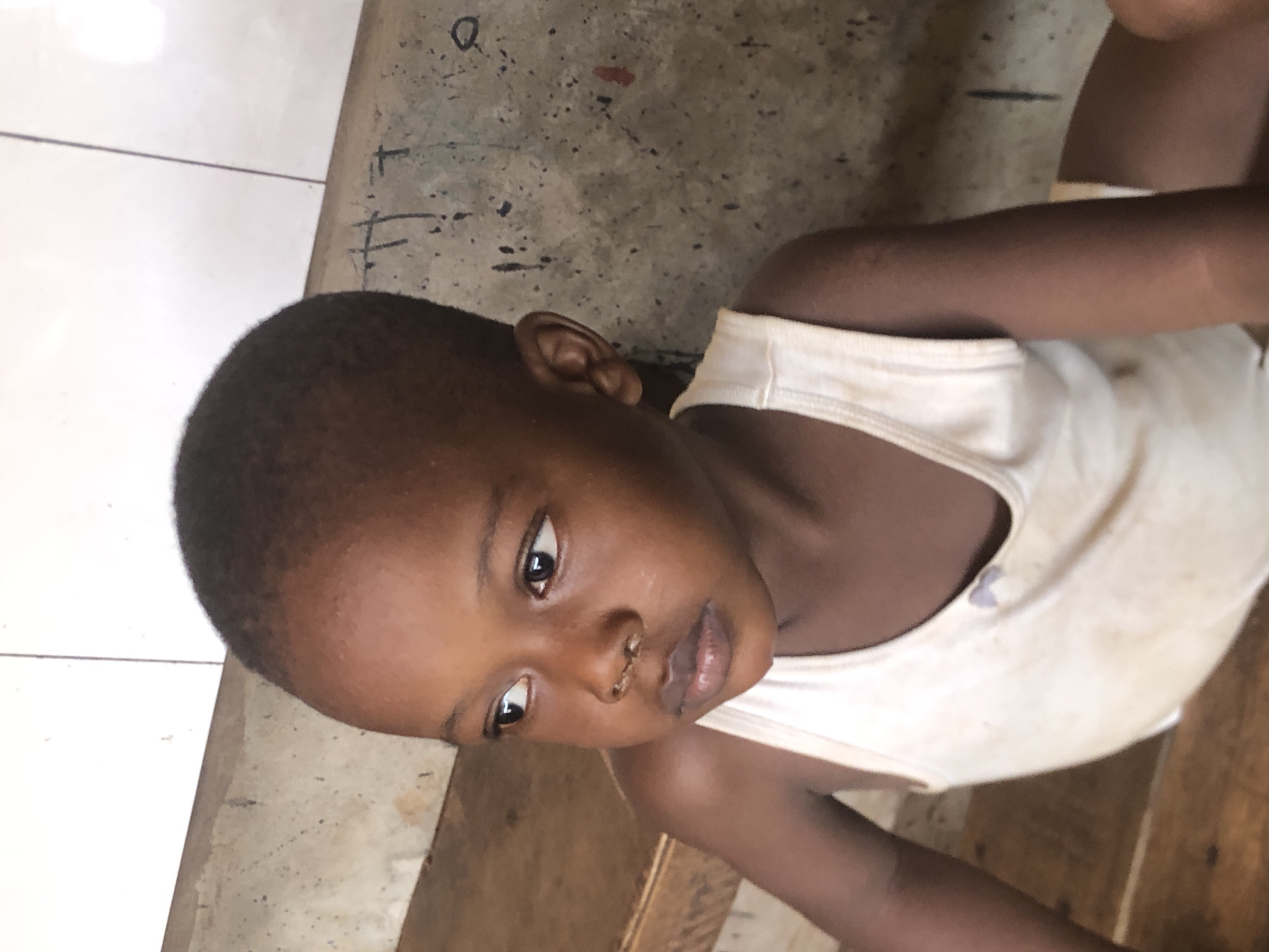 A young Black child wearing a white tank top sits on what appears to be a wooden bench. The child's nose appears injured. The background is a mix of concrete and white tile. The location is Ukwu-Abwa, Nigeria.