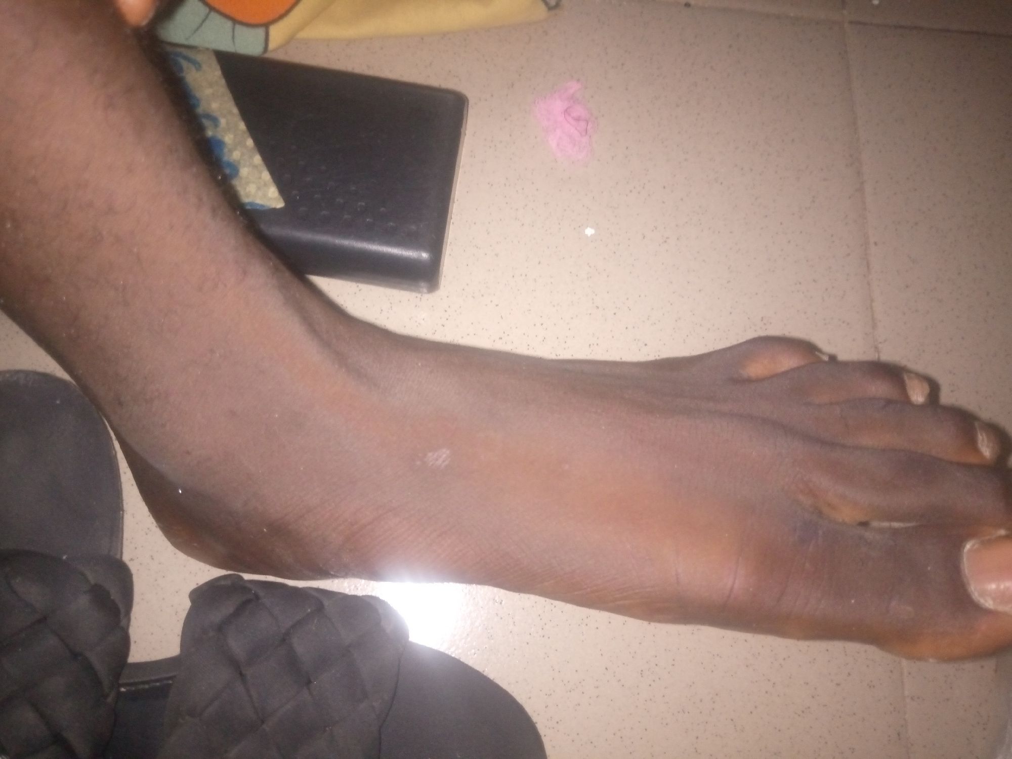 The image shows a close-up view of a person's foot and lower leg, with a black sandal visible in the foreground. The foot is resting on a light-colored tiled surface. In the background, a black electronic device is visible, along with a small piece of pink fluff. The scene appears to be indoors, possibly in a residential setting in Jalingo, Nigeria. The lighting is somewhat dim, casting shadows and creating a slightly diffused atmosphere.
