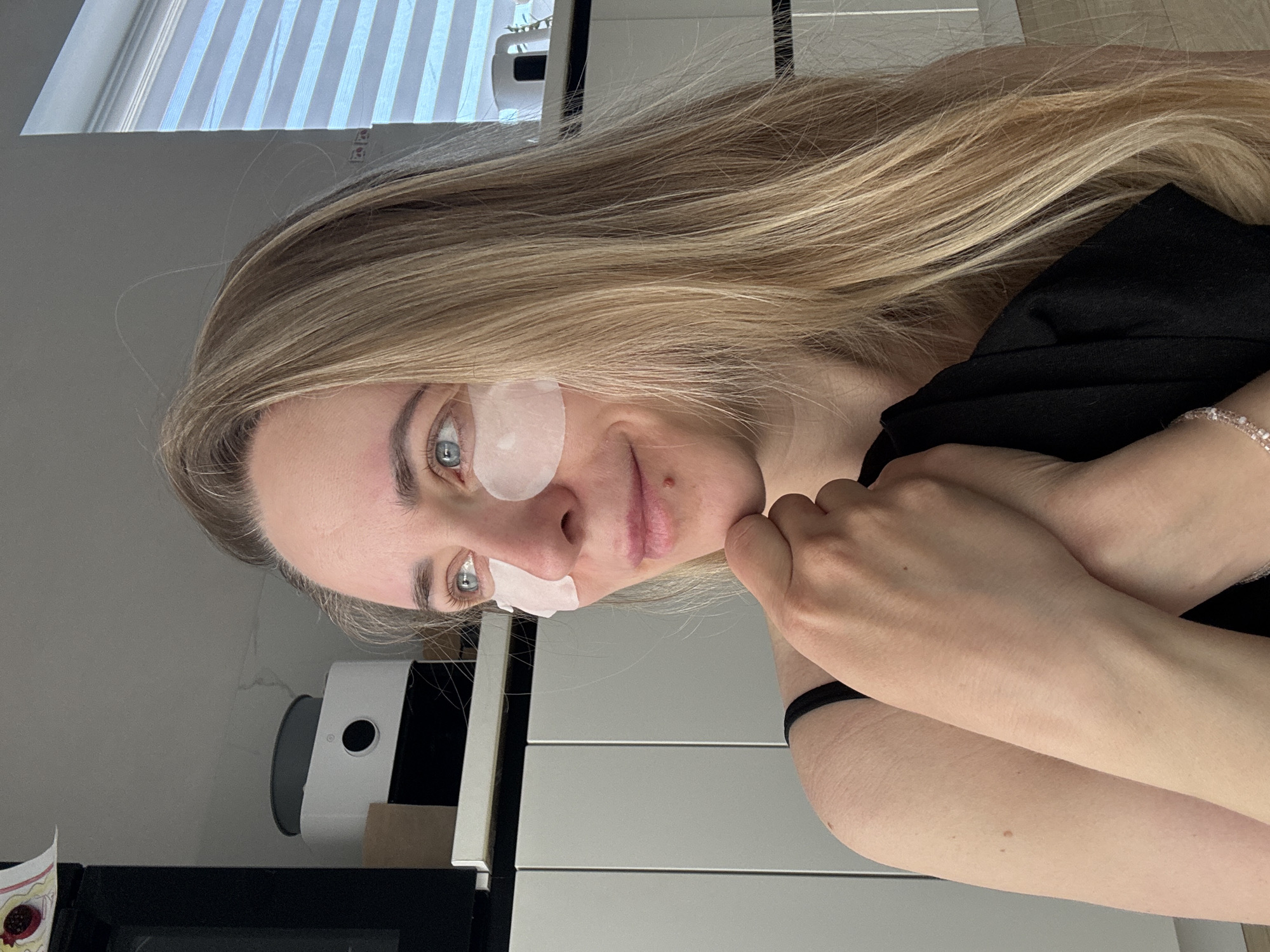 A woman with blonde hair has eye patches on and is wearing a black top. The background shows a window with blinds, a white object with a black circle, drawers, and part of a black object. It is not possible to identify if the image was taken in Chaikovsky, Russia.