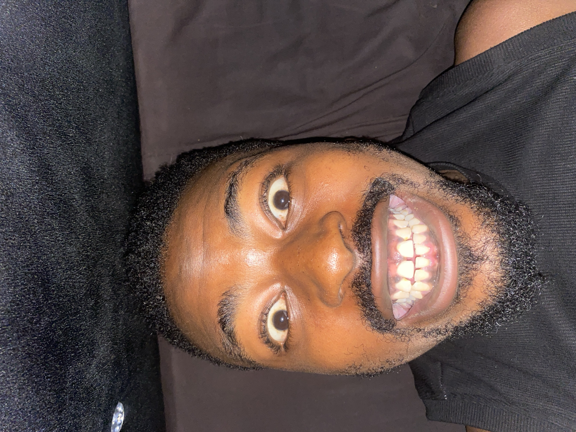 This media file presents a close-up portrait of a young Black man, oriented horizontally as if the camera or subject was tilted. He is smiling broadly, revealing both his upper and lower teeth, and looking directly into the camera with wide-open, expressive eyes. He has a short, dark, curly beard that covers his chin and jawline, and similar short, curly hair. His skin is a warm brown tone.
He appears to be lying down or resting against a dark background, which seems to be a plain, textured fabric, possibly upholstery of a sofa or a bed. A dark, ribbed t-shirt or top is visible on his right side. The lighting is focused on his face, suggesting an indoor setting, and might be artificial due to the sharp highlights.
Notable details include his teeth, which are visible and appear slightly yellowed, with one lower front tooth on his left side showing some misalignment or overbite. His gums are pink and healthy. The texture of his beard and hair is sharply defined. His expression conveys a sense of surprise, playfulness, or amusement. No visible text is present. Given the location context, this photo was taken in Barakin Akawo, Nigeria.