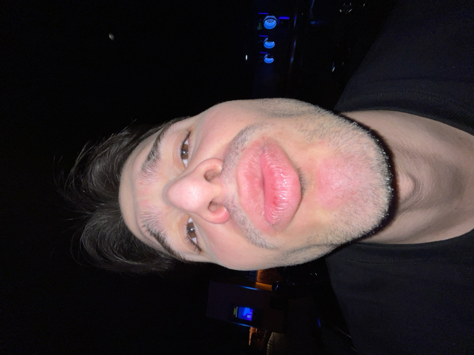 A rotated selfie captures a man in dim lighting. His face is close to the camera, highlighting his lips in a puckered expression. He has dark hair, fair skin, and brown eyes. A light stubble is visible on his face. The background is dark, but there are small lights visible in the top center, and a blue object can be seen in the bottom left. He is wearing a black shirt.