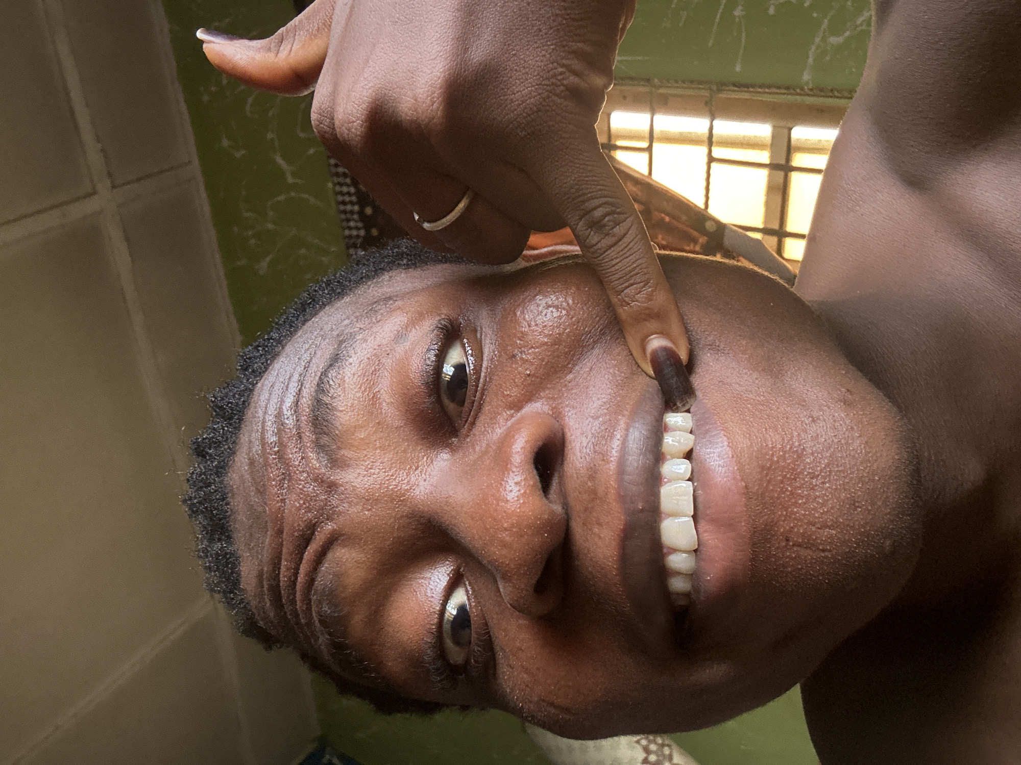 A close-up, rotated portrait captures a person with dark skin, their face angled towards the viewer. The person exhibits an expressive facial contortion, possibly a grimace or an exaggerated smile, with their mouth open to reveal a set of prominent, white, and seemingly healthy teeth. Their eyes look directly at the camera with intensity. Short, dark, curly hair frames the side of their head, and their skin shows a slight sheen.
A hand, also with a dark skin tone, is positioned with its index finger pointing directly at the person's teeth. A simple silver band ring is visible on the ring finger of this hand. The fingernail of the pointing index finger is long and has a dark tip.
In the background, to the upper right, a window with a grid-like pattern of horizontal and vertical bars is discernible, through which a warm, golden light streams, suggesting a daytime setting. Behind the person and to the left, a wall appears to be a mottled green with lighter, possibly white, textures or splatters. The entire image is oriented sideways, with the person's head tilted to the left. No text is visible in the media file.