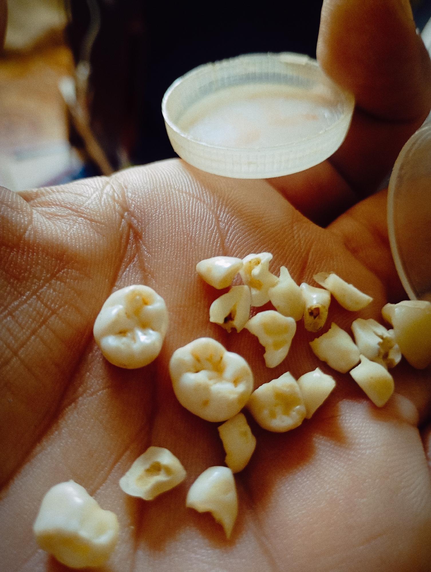A human hand holds a collection of loose teeth and a small plastic lid. The teeth vary in size and some appear to be broken. The background is blurry but suggests an indoor setting. There are no specific clues to suggest the location is Buenos Aires, Argentina.