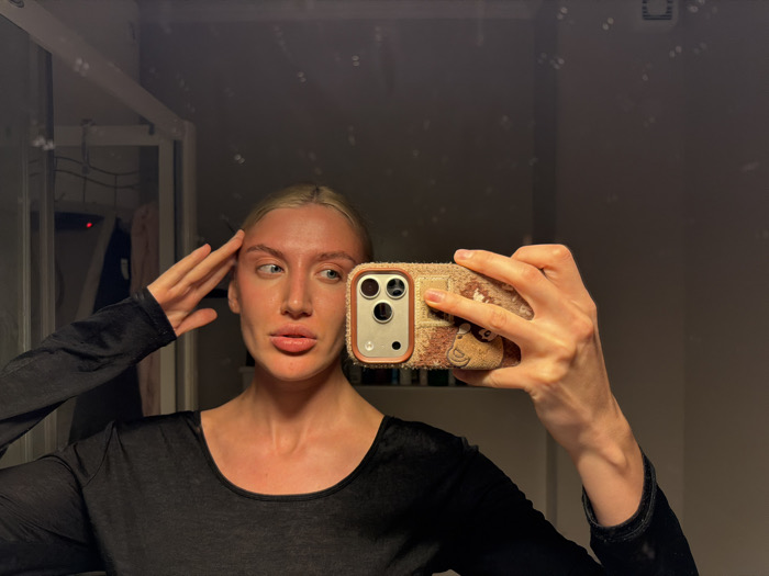 An indoor mirrored self-portrait depicts a young adult female. She possesses light blonde hair and exhibits prominent erythema across her face, neck, and upper chest. She wears a black, long-sleeved top with a scoop neckline. The subject is holding a smartphone in her right hand to capture the reflection; the phone is equipped with a multi-lens camera and encased in a textured, light brown case featuring a small, darker brown bear-shaped appliqué. Her left hand is positioned on her left temple, fingers splayed. Her lips are slightly pursed, and her blue eyes gaze towards the viewer's left. The mirror surface displays multiple small smudges or droplets. The reflected background reveals a dimly lit interior space, including a partial white vertical frame, a dark hanging object, and a faint red indicator light in the upper left quadrant. The specific location within Budva, Montenegro, cannot be determined from the visual information provided in the image.
