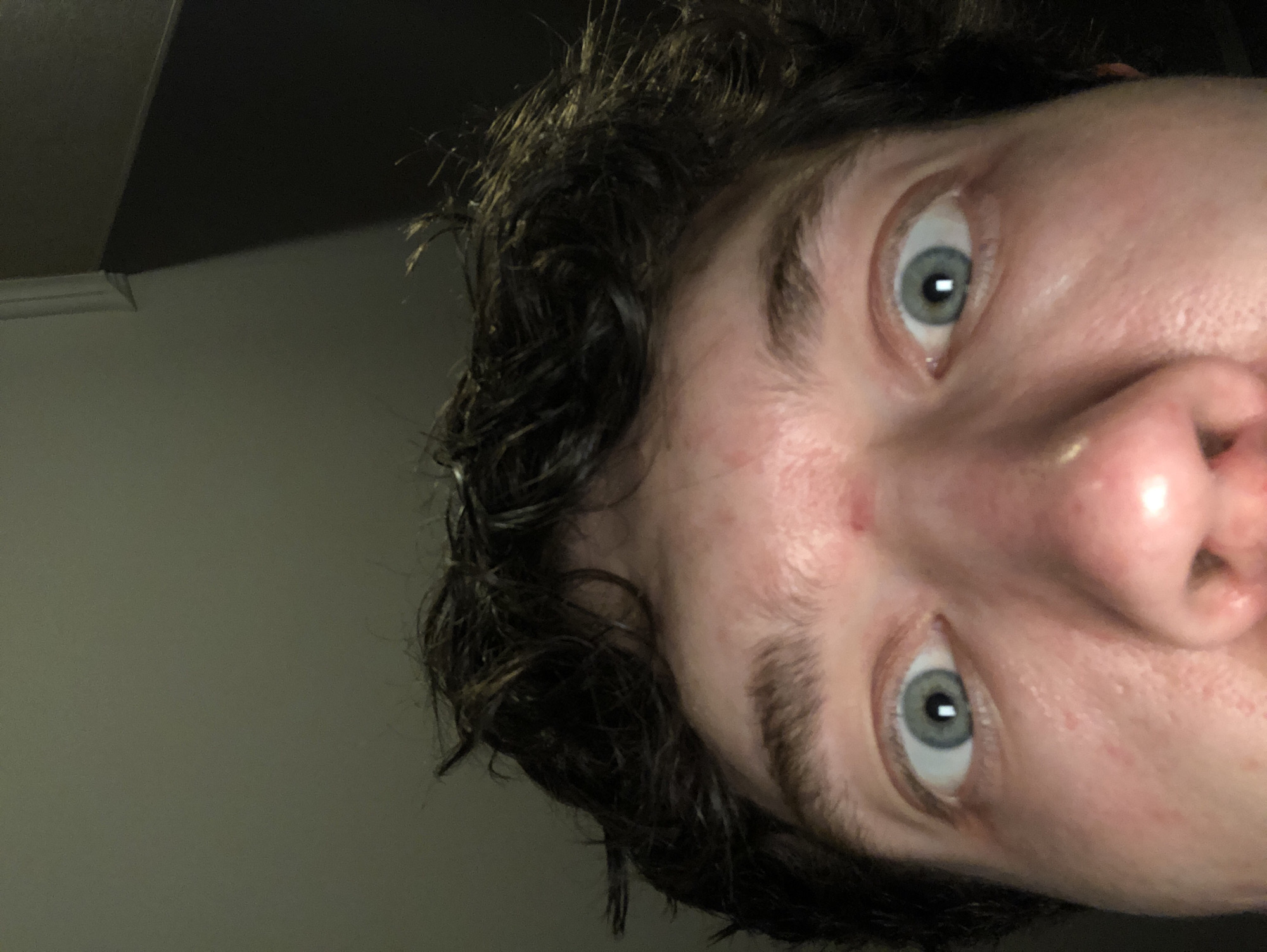A close-up, rotated view of a person's face. The person has short, dark, curly hair, light skin with some blemishes, light-colored eyes, and a large nose. The background is a wall, partially shadowed, with a portion of a ceiling visible in the upper left. The location is unknown.