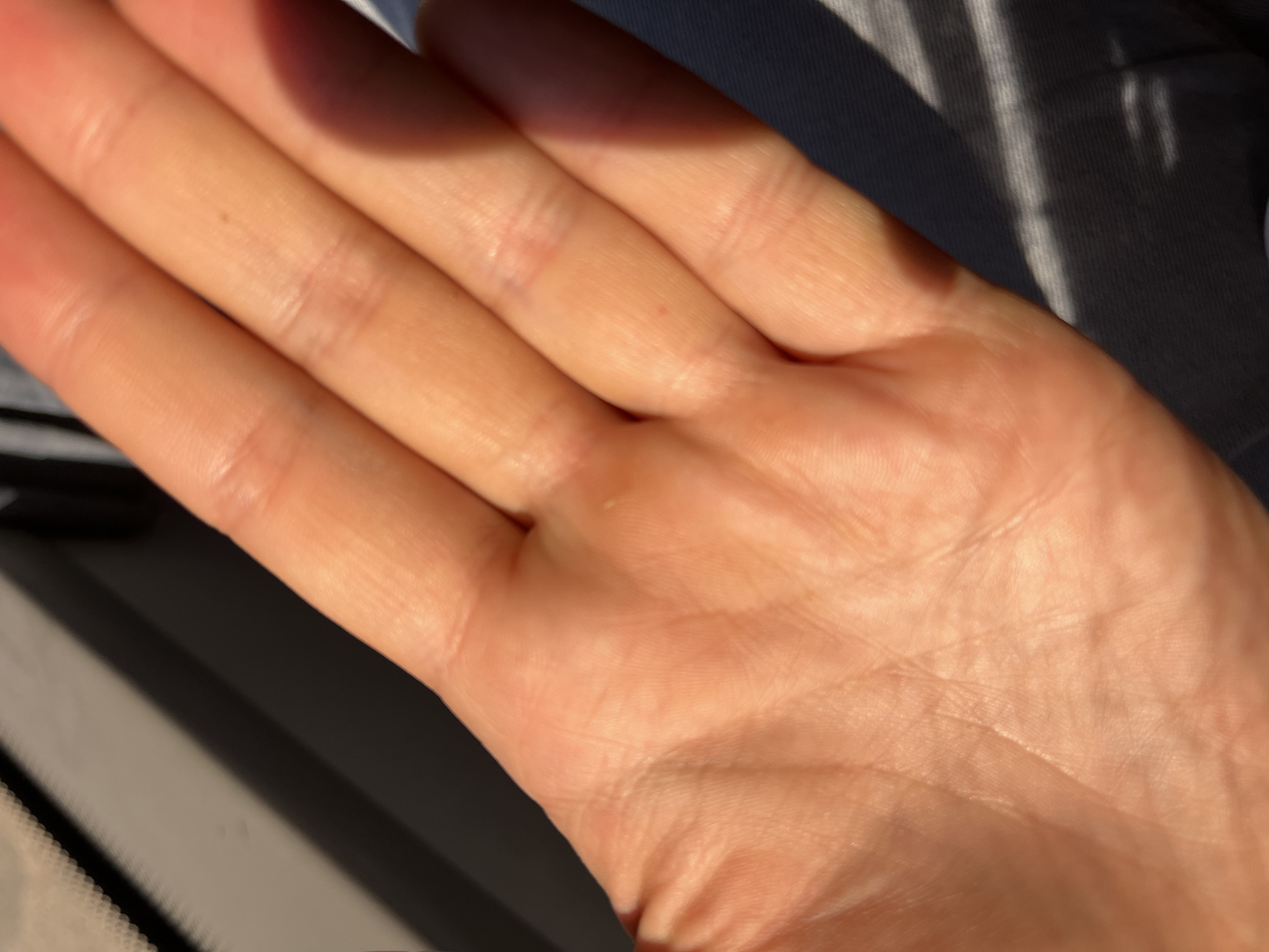 A close-up, overhead shot displays the palm of a hand illuminated by sunlight, casting shadows across the skin and creating a striped pattern. The hand, with its visible creases and texture, is positioned against a dark, textured background, possibly fabric. The lighting suggests an outdoor setting. The location is the city of Myadzyel, Belarus.
