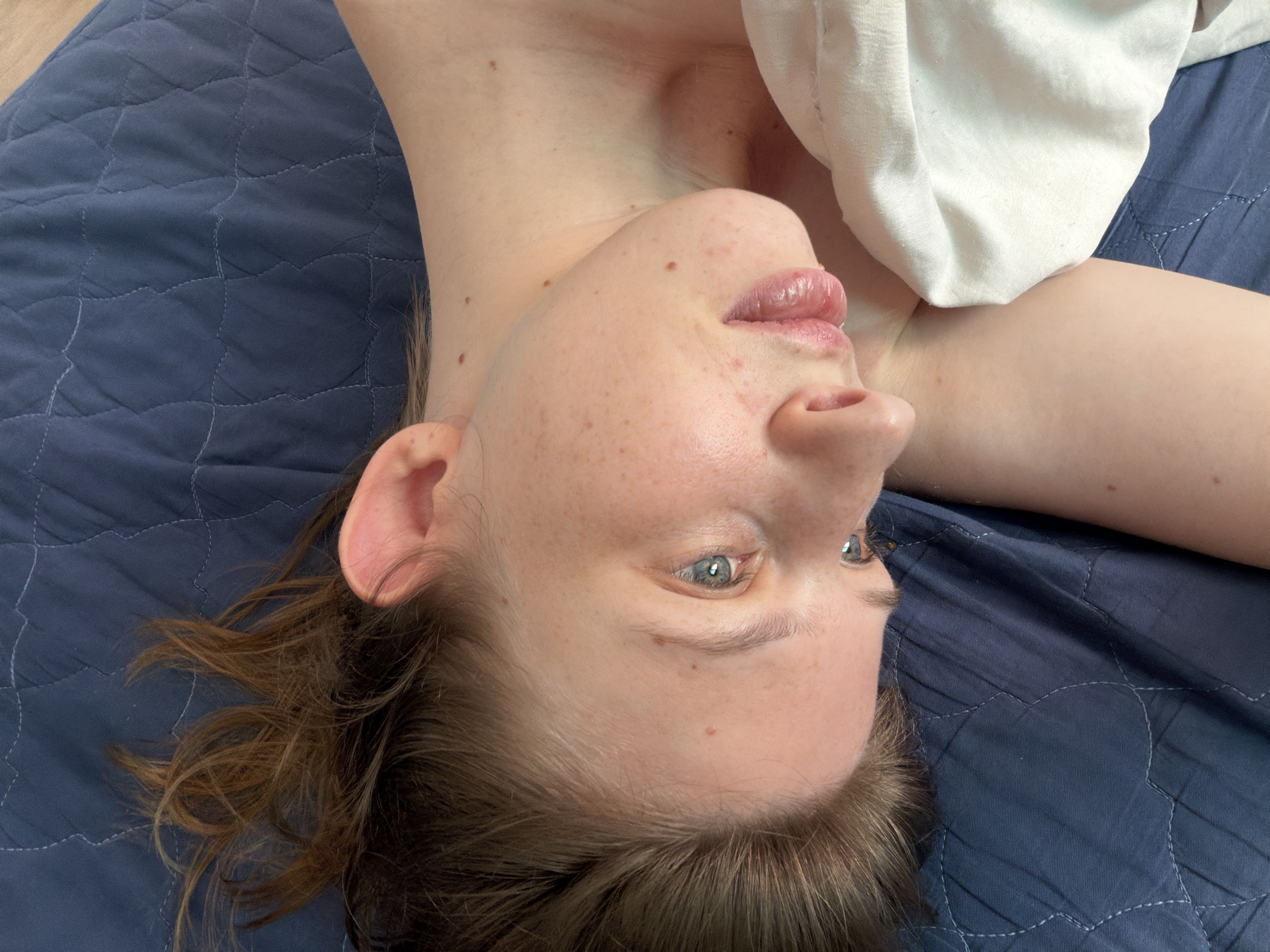The image shows an upside-down close-up of a person's face and upper body lying on a dark blue quilted surface. The person has fair skin with freckles and some acne blemishes. Their eyes are blue and looking upwards. Their lips are slightly parted and appear to be painted with a glossy lipstick. A white cloth is draped over their shoulder. The background is a dark blue quilted fabric, possibly a blanket or duvet. There are no discernible city landmarks or specific geographical features visible in the image.