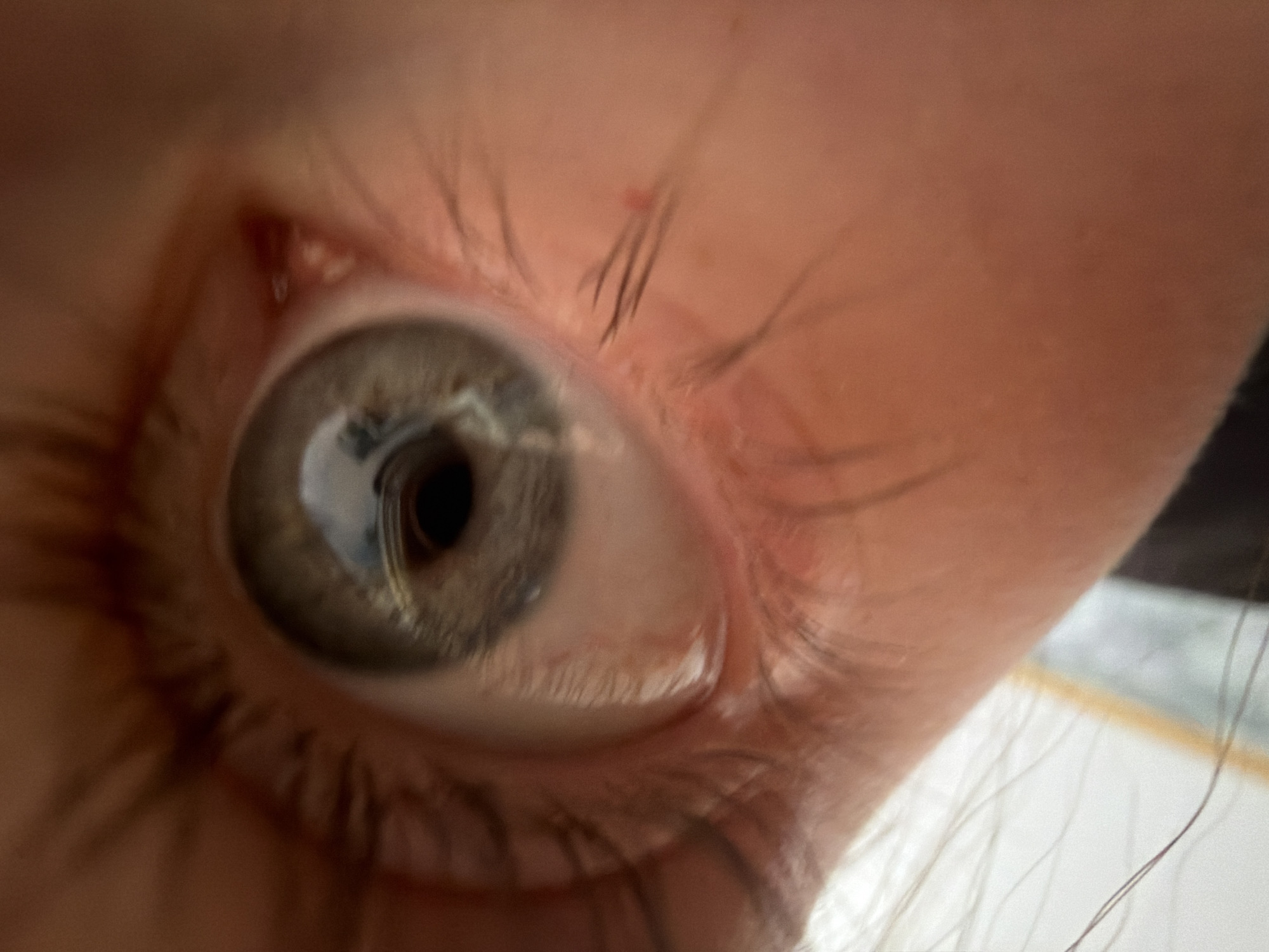 A very close-up, high-magnification photograph features a human right eye, likely belonging to a young individual given the smooth skin texture. The eye is open, with the person appearing to gaze directly towards the camera or slightly upwards. The iris is a desaturated grey-green or hazel color, and the pupil is notably dilated, reflecting a bright light source, possibly a window or overhead fixture.
Long, dark eyelashes frame both the upper and lower eyelids. Several individual upper lashes are sharply in focus and prominent. The skin surrounding the eye is a natural, warm tone, exhibiting minimal fine lines. A small, reddish bump or mark is visible on the upper eyelid, near the base of the eyelashes in the upper-right quadrant of the image. The extreme close-up creates a shallow depth of field, rendering the background out of focus. No specific activity is depicted beyond the act of observing. There is no visible text. The image's context is Perm, Russia.