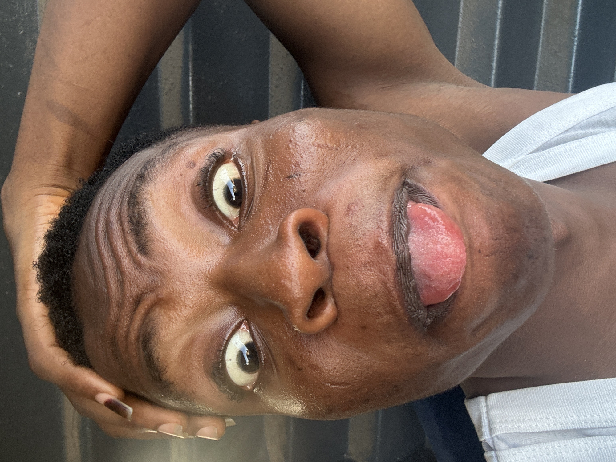 A close-up, slightly off-kilter image captures an individual with dark skin, possibly female, displaying their tongue. The person's face is tilted, with large, expressive eyes open wide. Skin appears moist, perhaps sweaty. One hand is visible near the head, with manicured nails. The background is indistinct, suggesting an outdoor or semi-outdoor location. Details about the location are not discernible from the image.