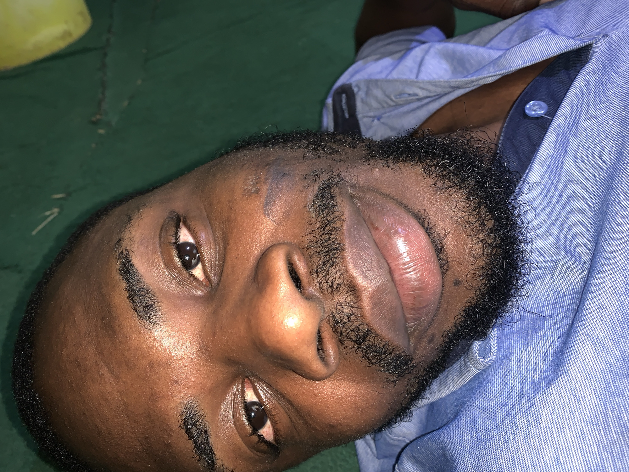 The image shows a close-up, rotated view of a Black male's face and upper chest, with his head tilted to the side. He has dark skin, dark eyes, and a neatly trimmed beard and mustache. He is wearing a light blue collared shirt with a button closure. The background is a dark green surface, possibly a floor or ground, with a bright yellow object visible in the upper left corner. The lighting appears to be artificial and somewhat dim, casting shadows on his face. There are no visible signs of injury or distress. The location of Rafin Par, Nigeria, is mentioned but there are no specific visual cues in the image to confirm or deny this location.