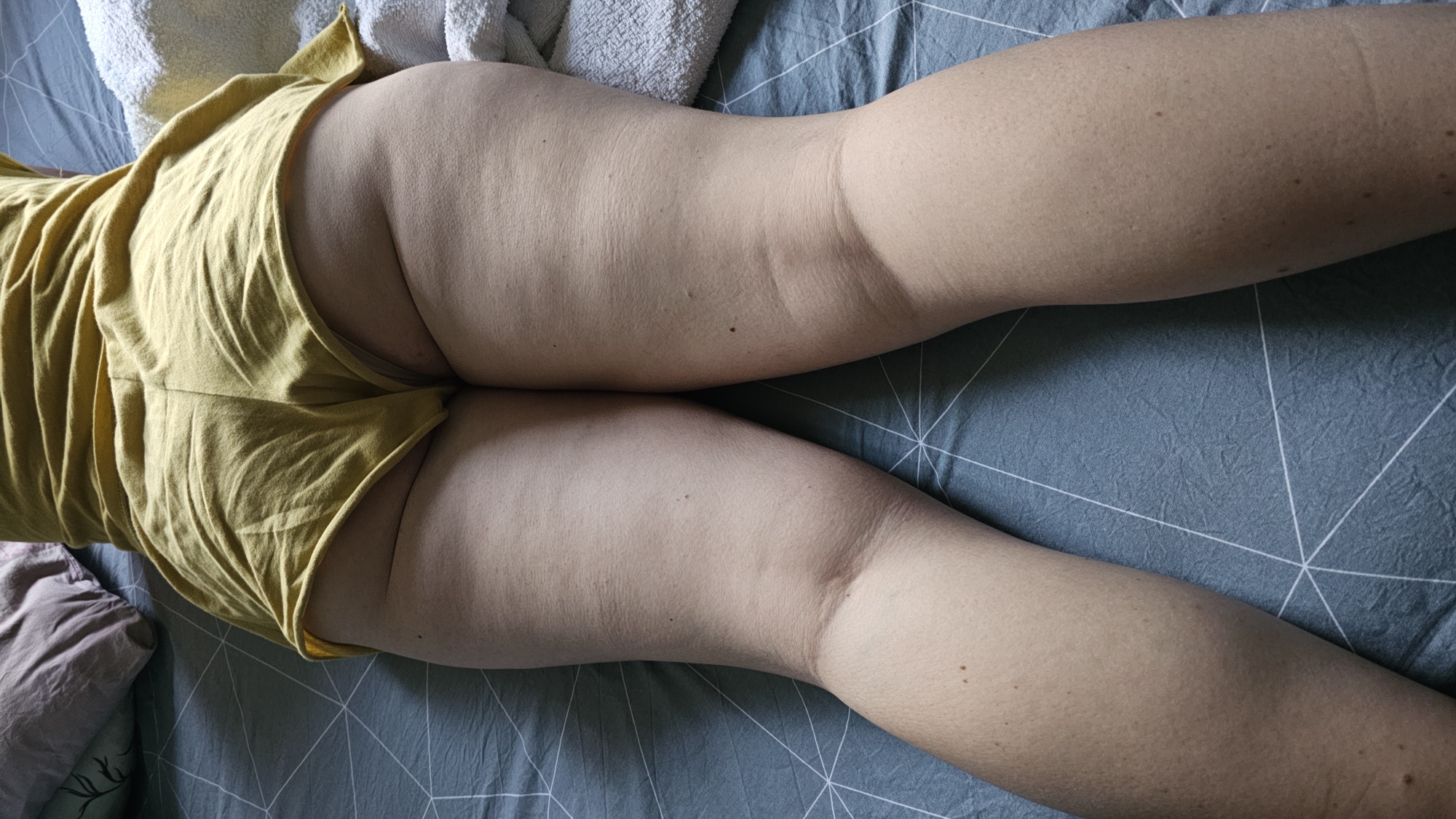 This media file depicts a close-up view of a person's lower body, specifically their buttocks and thighs. The person is lying on a bed with blue and white patterned bedding. They are wearing yellow shorts that are slightly pulled to the side, revealing the skin of their buttocks. The lighting suggests an indoor setting, possibly during the daytime. There are no explicit indications of the time of day or weather conditions. The scene is a private, intimate one, focusing on the form and texture of the skin and fabric. The setting appears to be a bedroom or a similar domestic space. There is no visible text in the image.