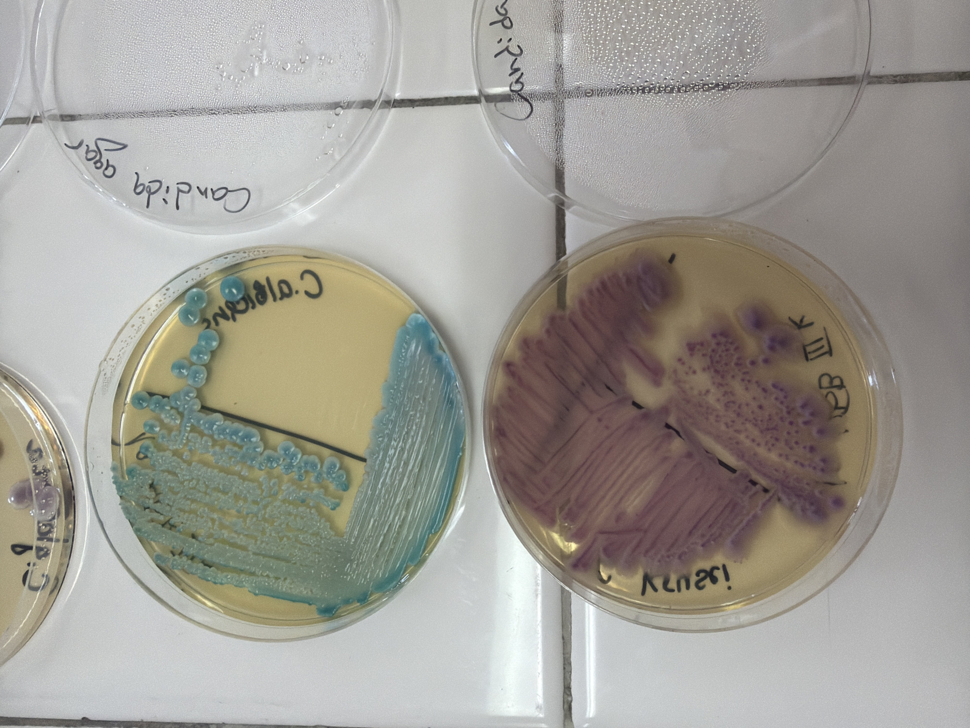The image depicts four petri dishes on a white tile surface, likely within a laboratory setting. Two dishes in the upper portion of the image are transparent and labeled "Candida Agar". The lower two petri dishes contain cultured microorganisms. The dish on the left displays blue-green colonies labeled "C. Albicans", indicating a likely culture of Candida albicans. The dish on the right exhibits pink-purple colonies labeled "C. Krusei". The writing "PB III K" is also visible on this dish. There is no information to indicate the location is Plovdiv, Bulgaria. The details included are those of the Petri dishes only.